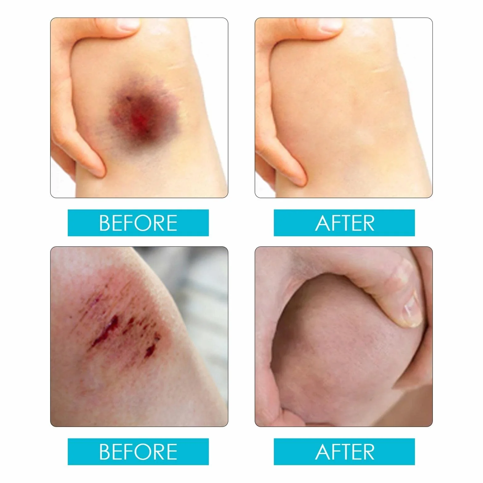 Yeso Líquido Bandage Spray 30ml Impermeable Transpirable Secado Rápido Película Protectora Heridas