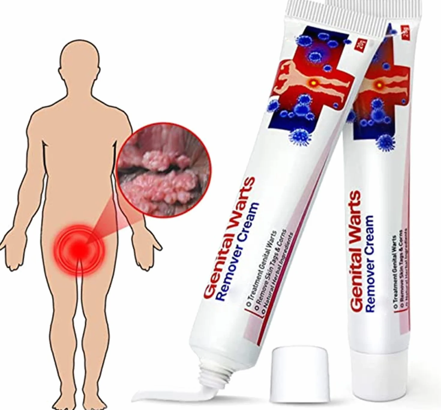 Remover Wart Ointment Genital Vulva Condyloma Acuminatum Treatment Cream Plantar (2pcs)