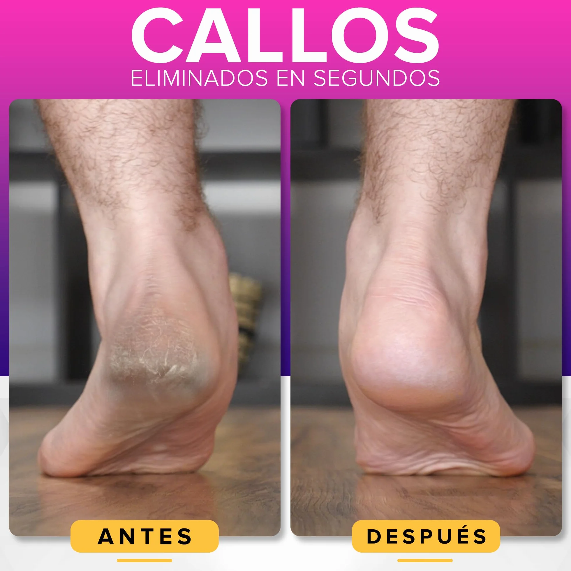 Lima Pies Durezas A PRUEBA DE ÓXIDO Con Recogedor Tamaño XL Removedor De Callos Uso En Seco Y Húmedo Quita Durezas Agarre Antideslizante