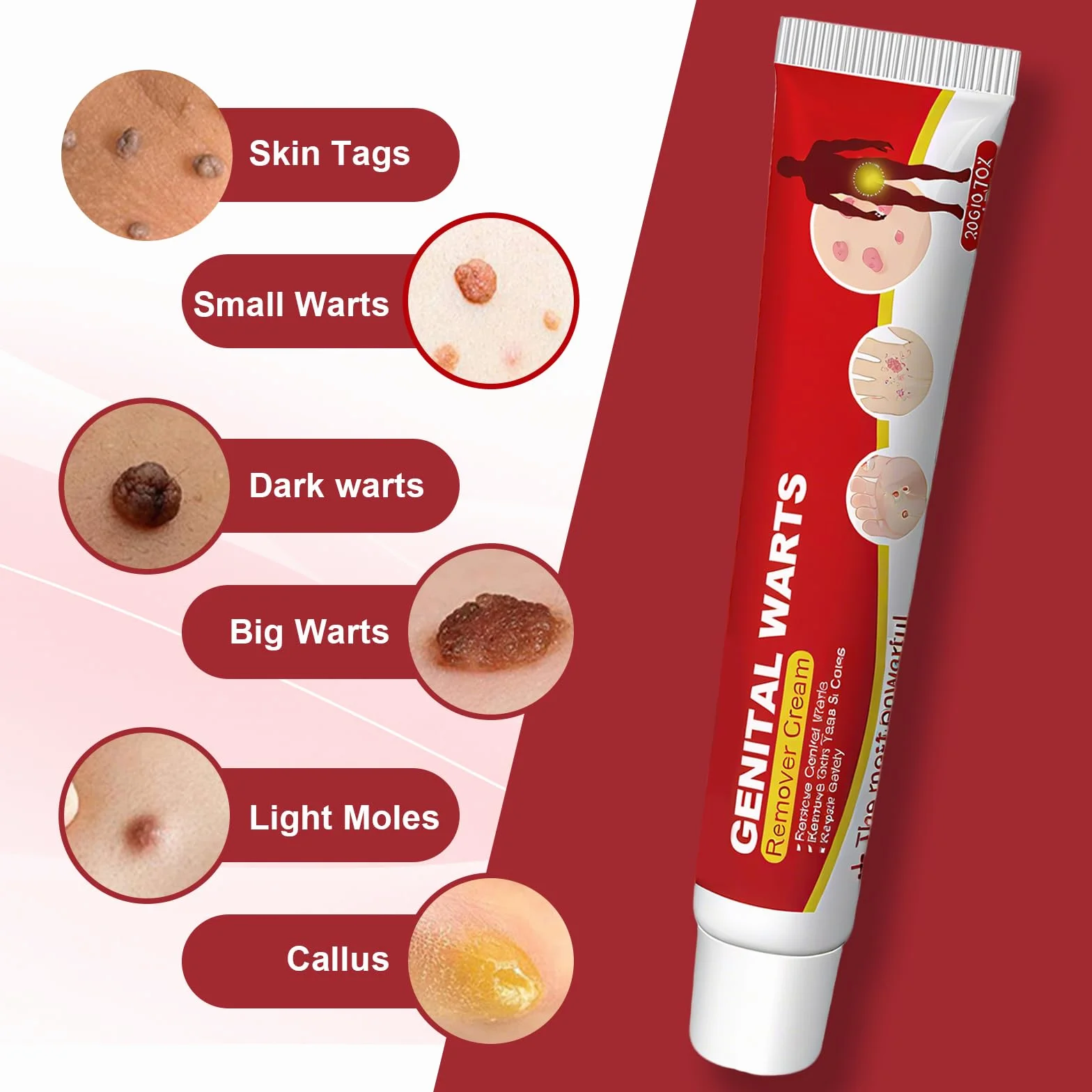 Crema Eliminador De Verrugas Piel 20g