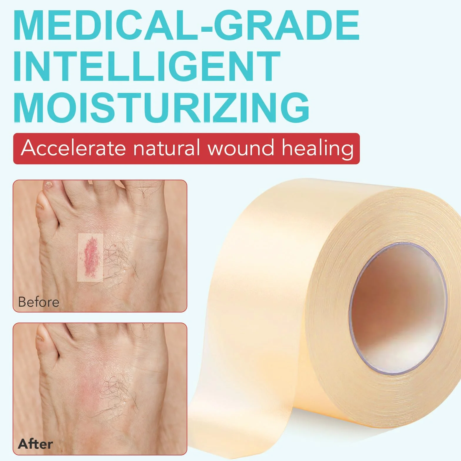 Apósitos Hidrocoloides Rollo 5cm x 360cm Vendas Impermeables Gel Hidrocoloide Transpirable Cortable