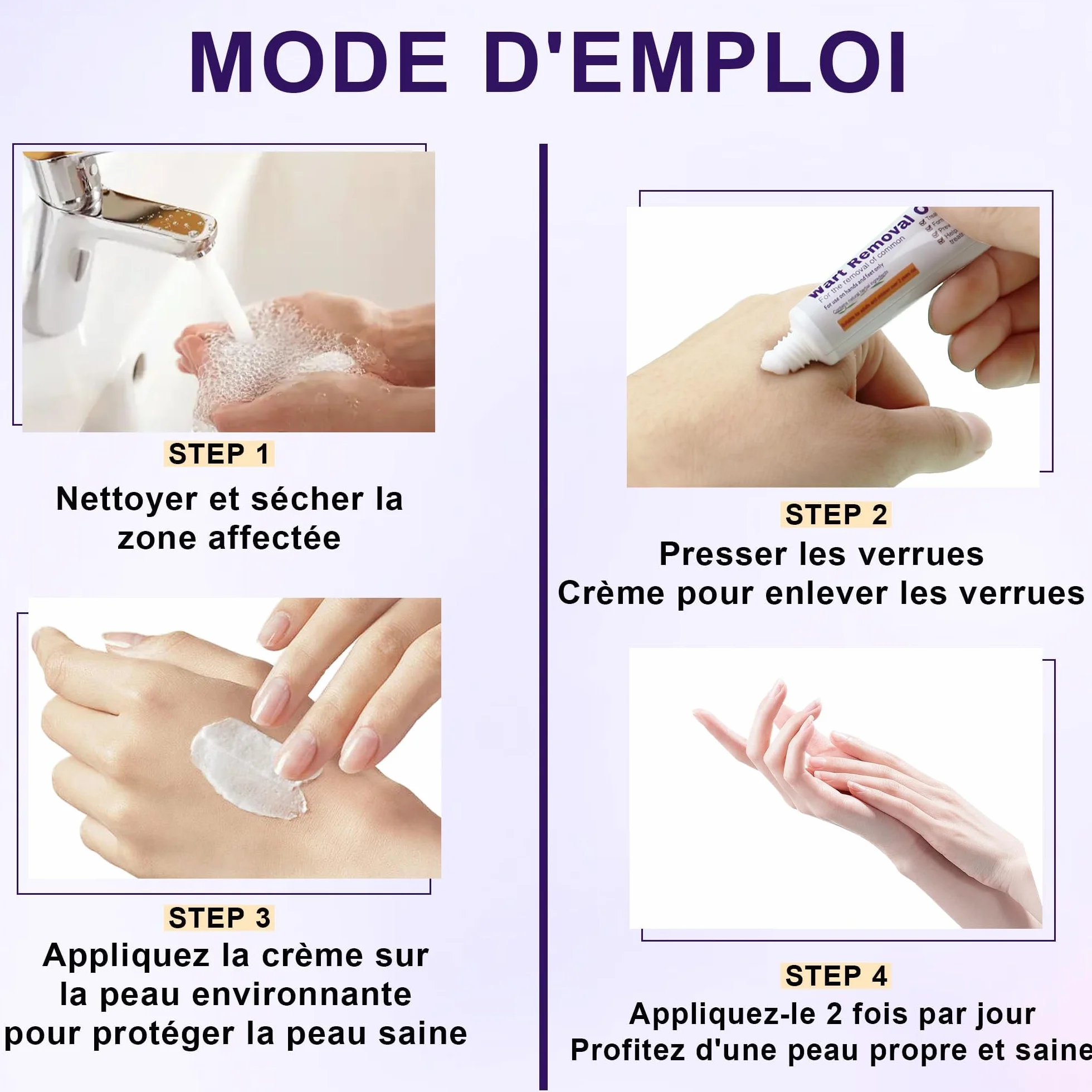 Crema eliminar verrugas 20g para verrugas plantares