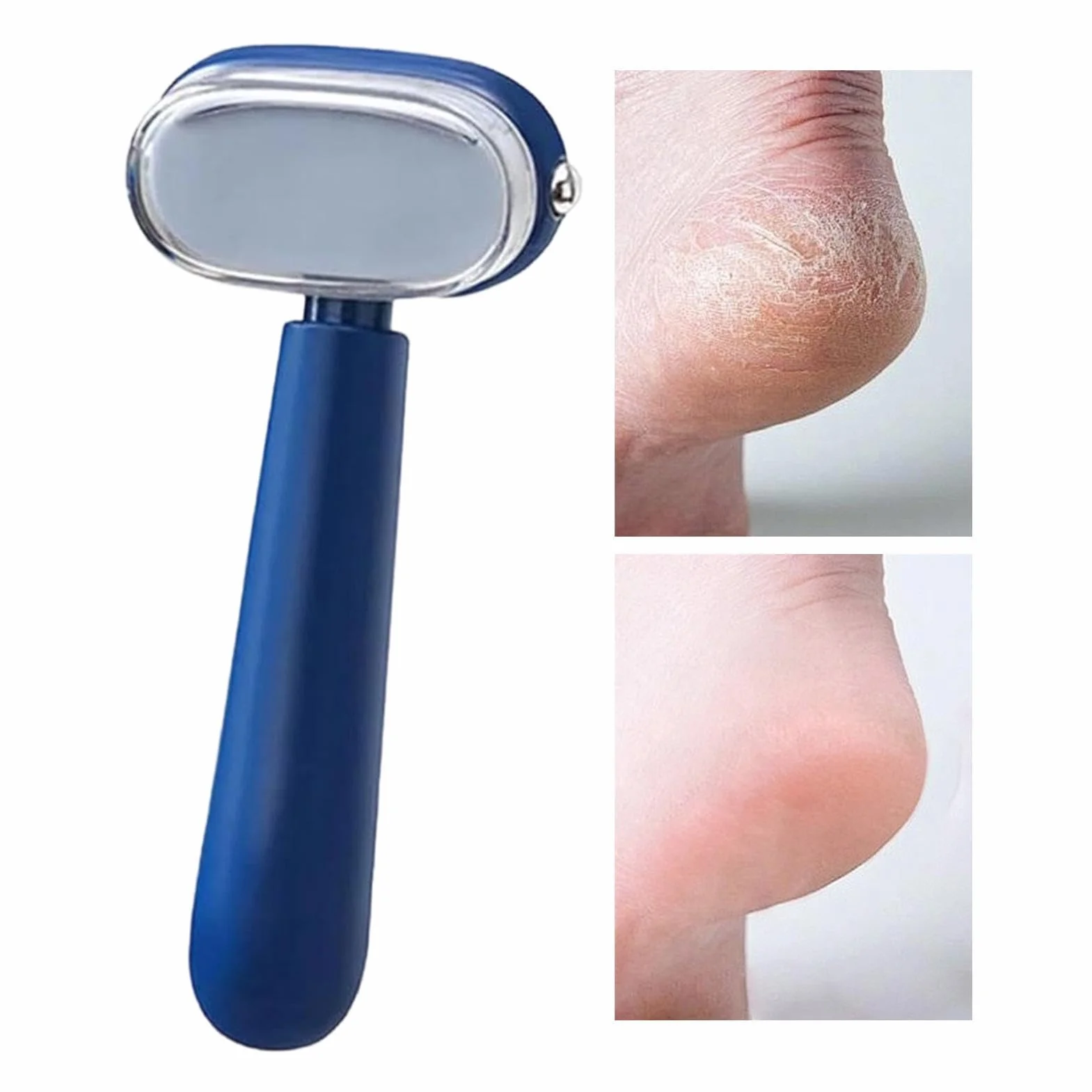 Rallador de pie Eliminador manual de callos para tacones