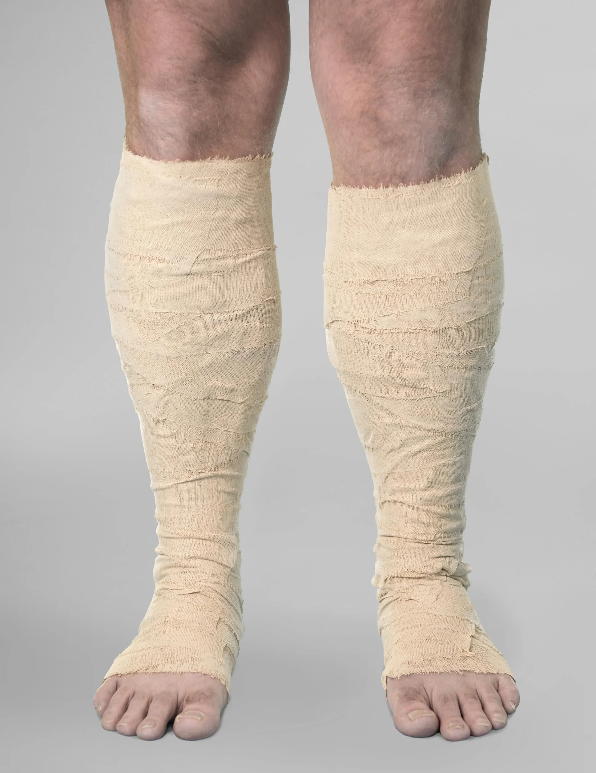 ICHTHOPASTE Vendaje médico 7,5 cm x 6 m