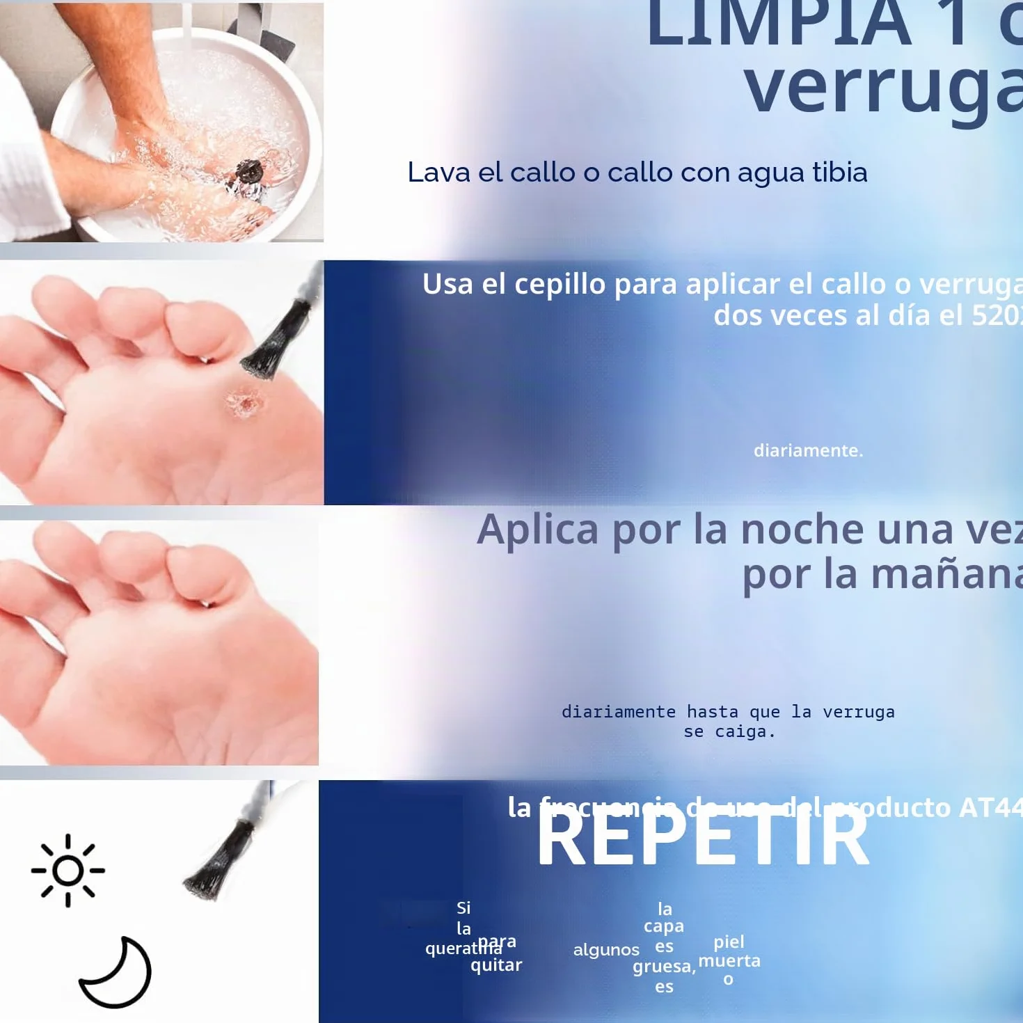 Removedor de Maíz con Veneno de Abeja 20 ml Máxima Potencia Eliminador de Callos Líquido para Pies
