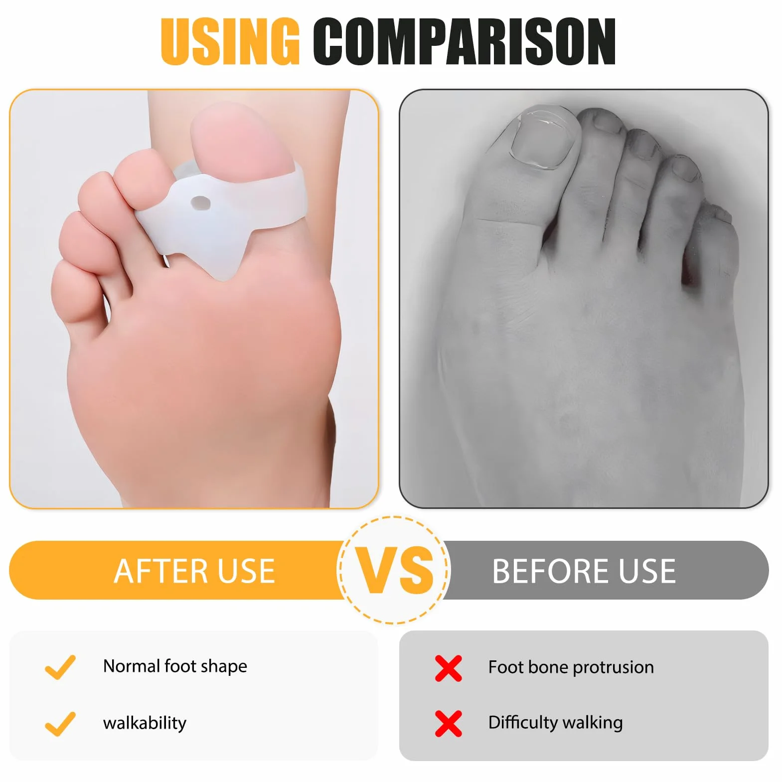 Separador Dedos Pie Hallux Valgus Juanetes Flexibles Alineación Dedo Pack 12 Blanco