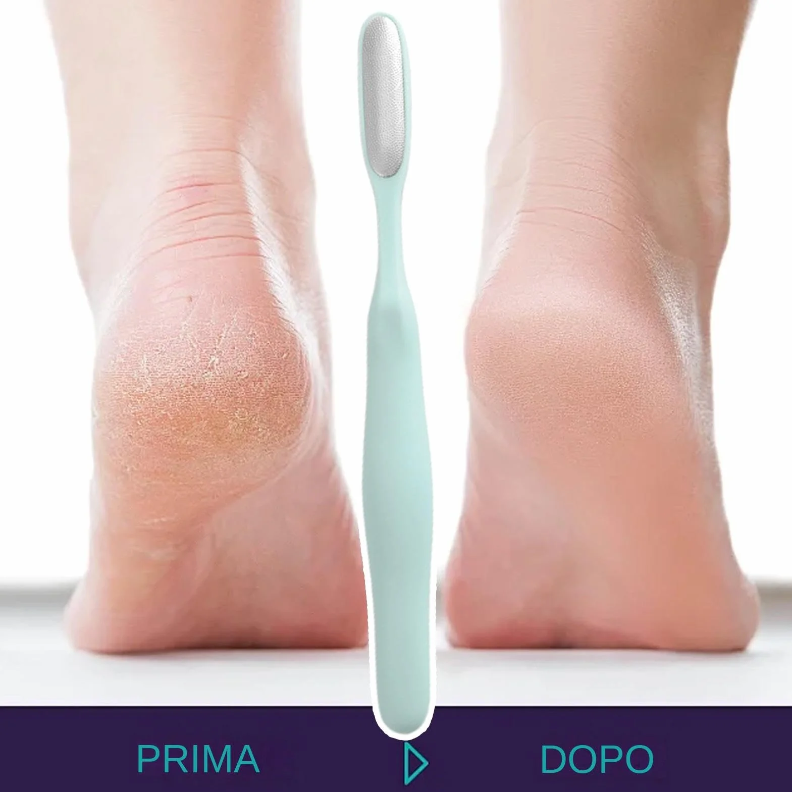 Cepillo de limpieza de acero inoxidable para eliminar callos y piel agrietada de los pies