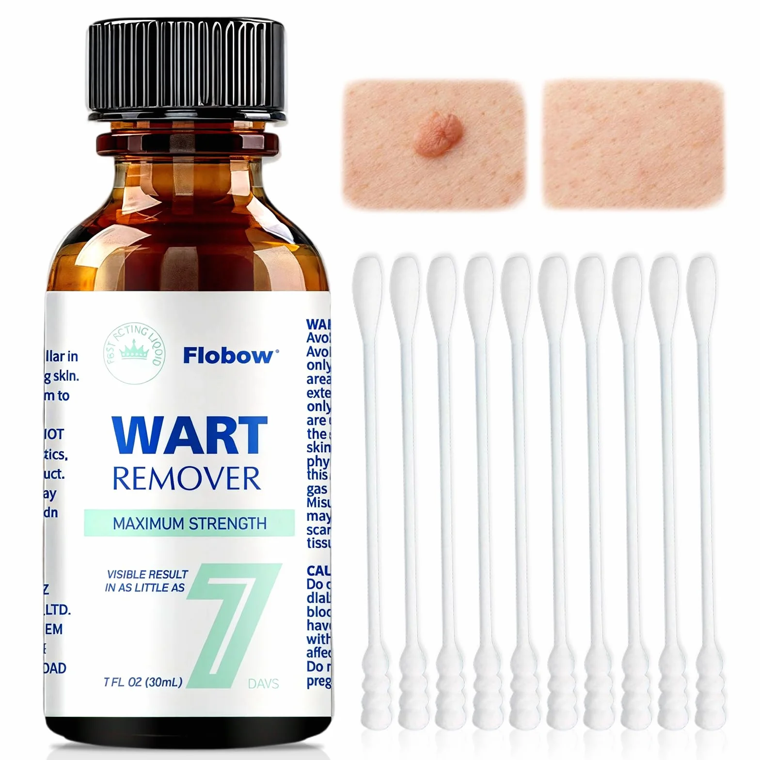 Líquido exfoliante para verrugas 30 ml cuidado piel áspera