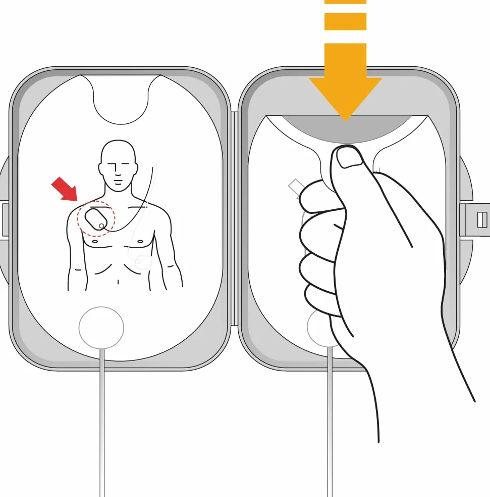 Philips HeartStart FRx Desfibrilador Cartucho de electrodos SMART II