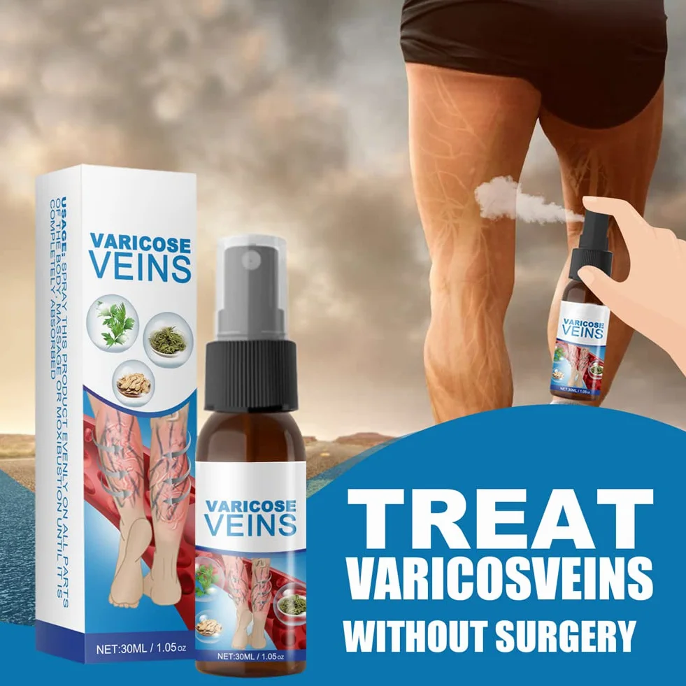 Spray Calmante para Venas Varicosas, Tratamiento de Varices, Alivio Dolor Pierna Circulación Sanguínea