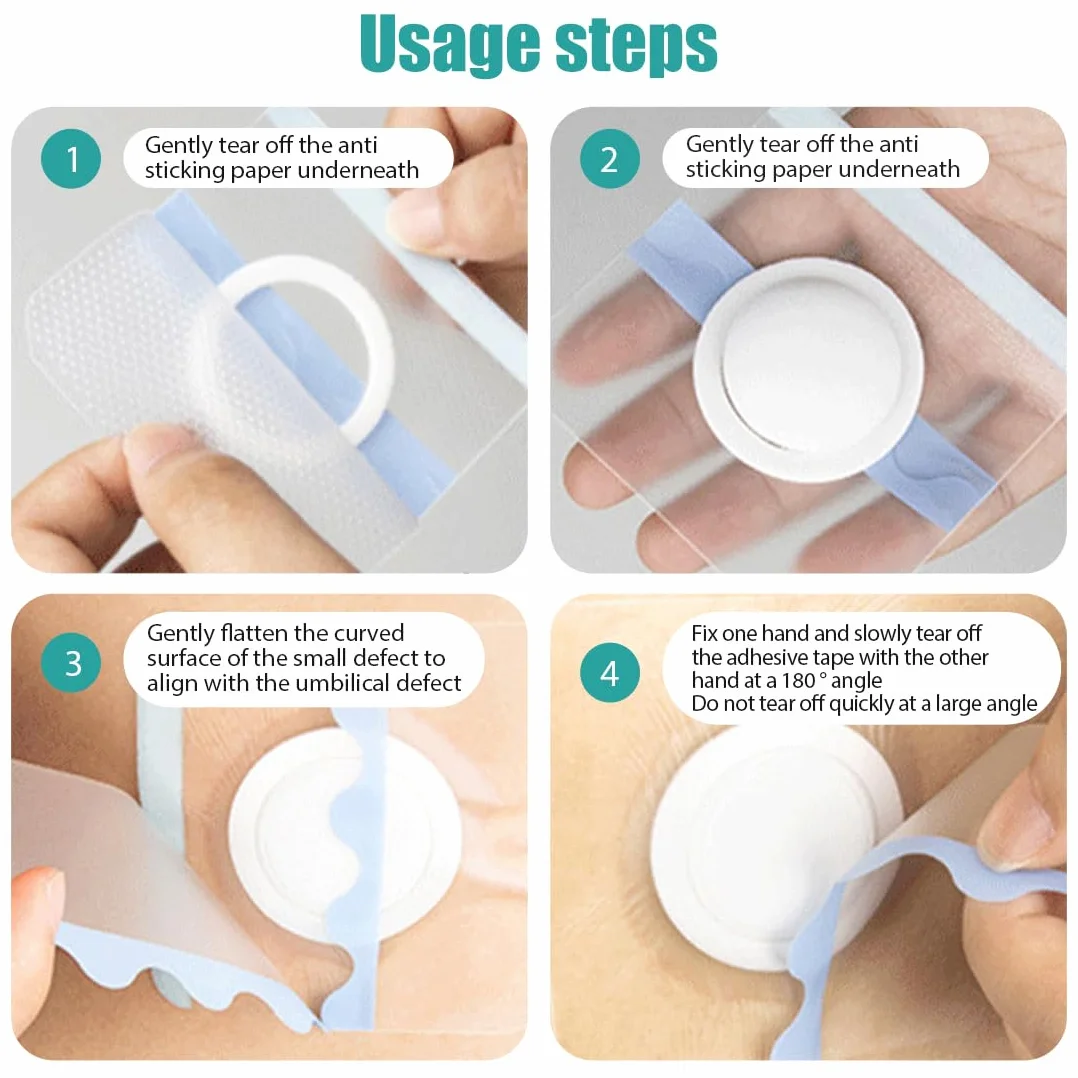 GXGM Cordon Umbilical Bebé Hernia Protección Cinta Adhesiva PU Suave Transpirable