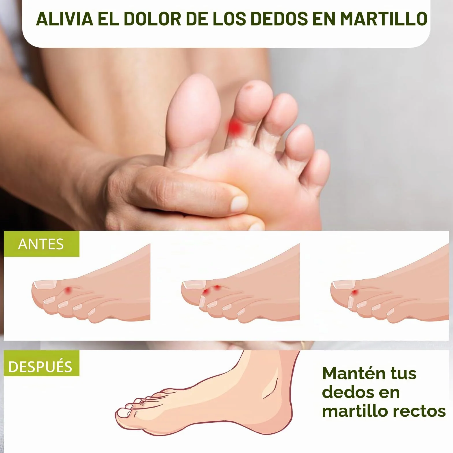 Bukihome 6 Piezas Enderezador de dedos en martillo, vendas de tela reutilizable, Beige