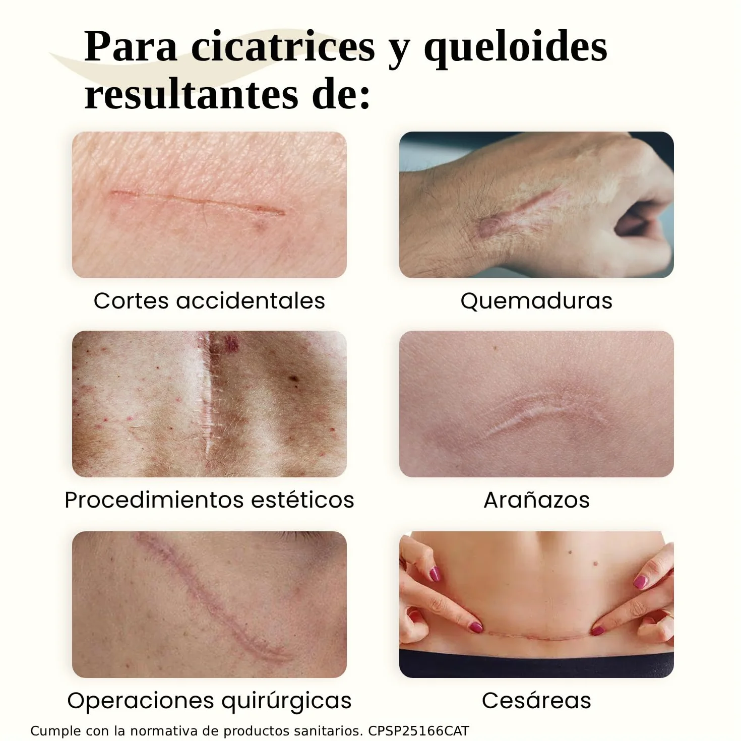 Dermatix Gel para Tratamiento de Cicatrices 15g