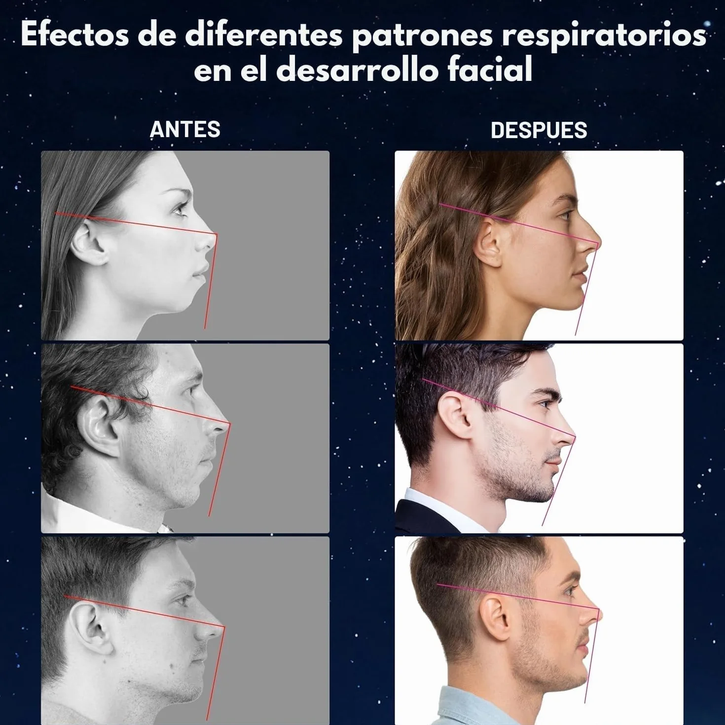 HN PACK AHORRO 150 Tiras Bucales Para Dormir Antironquidos Adhesivo Hipoalergénico Mouth Tape