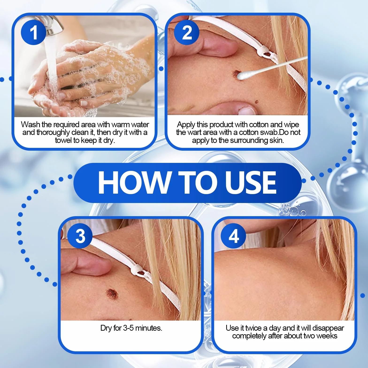 Líquido exfoliante para verrugas 30 ml cuidado piel áspera
