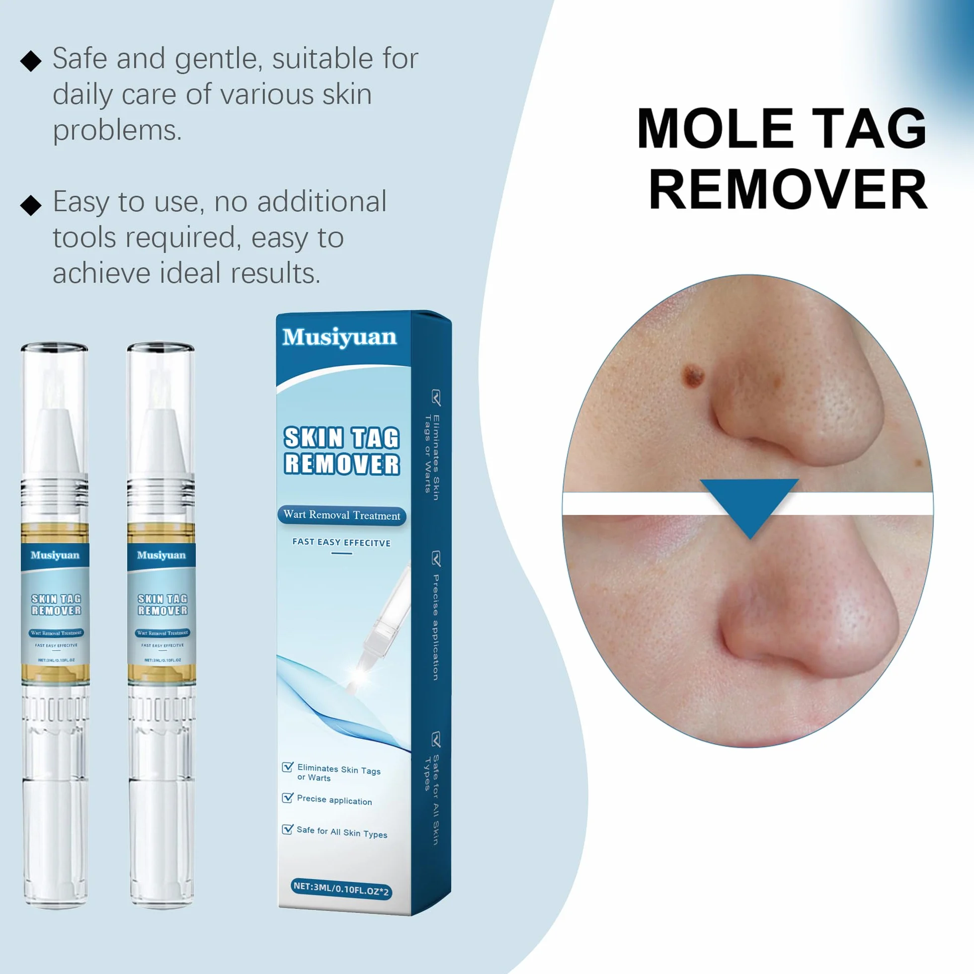 Kit removedor de verrugas para cuerpo y manos, paquete de 2