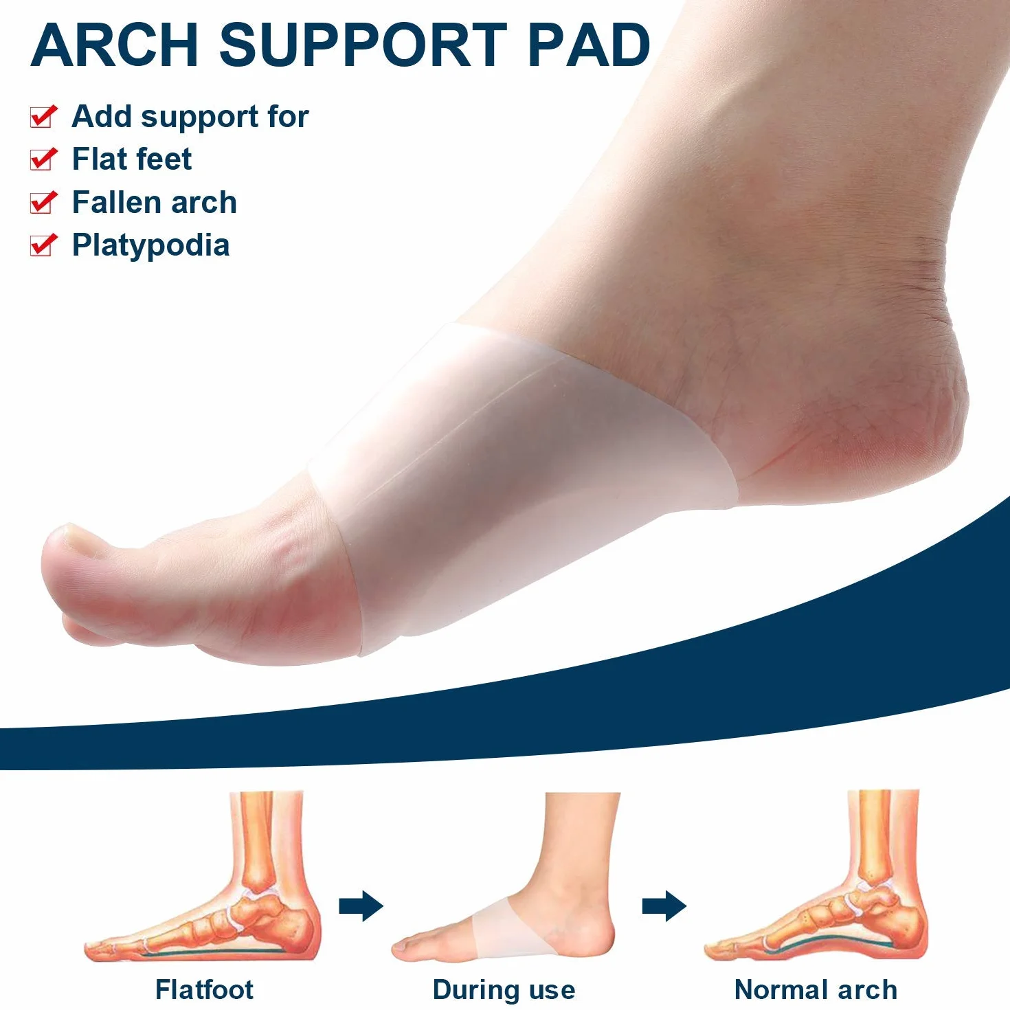 Almohadillas de gel para soporte de arco pies planos, fascitis plantar, espolones del talón