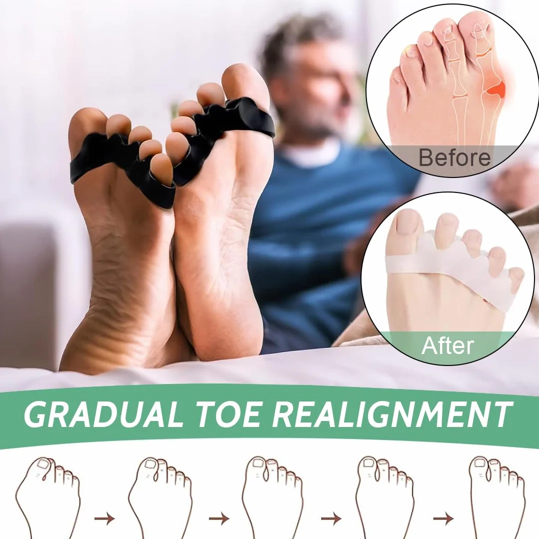 Separadores de Dedos de Los Pies 3 Pares, Separador Dedos Pie Silicona, Toe Spacer para Juanete, Ajuste Atletas Hombre Mujer