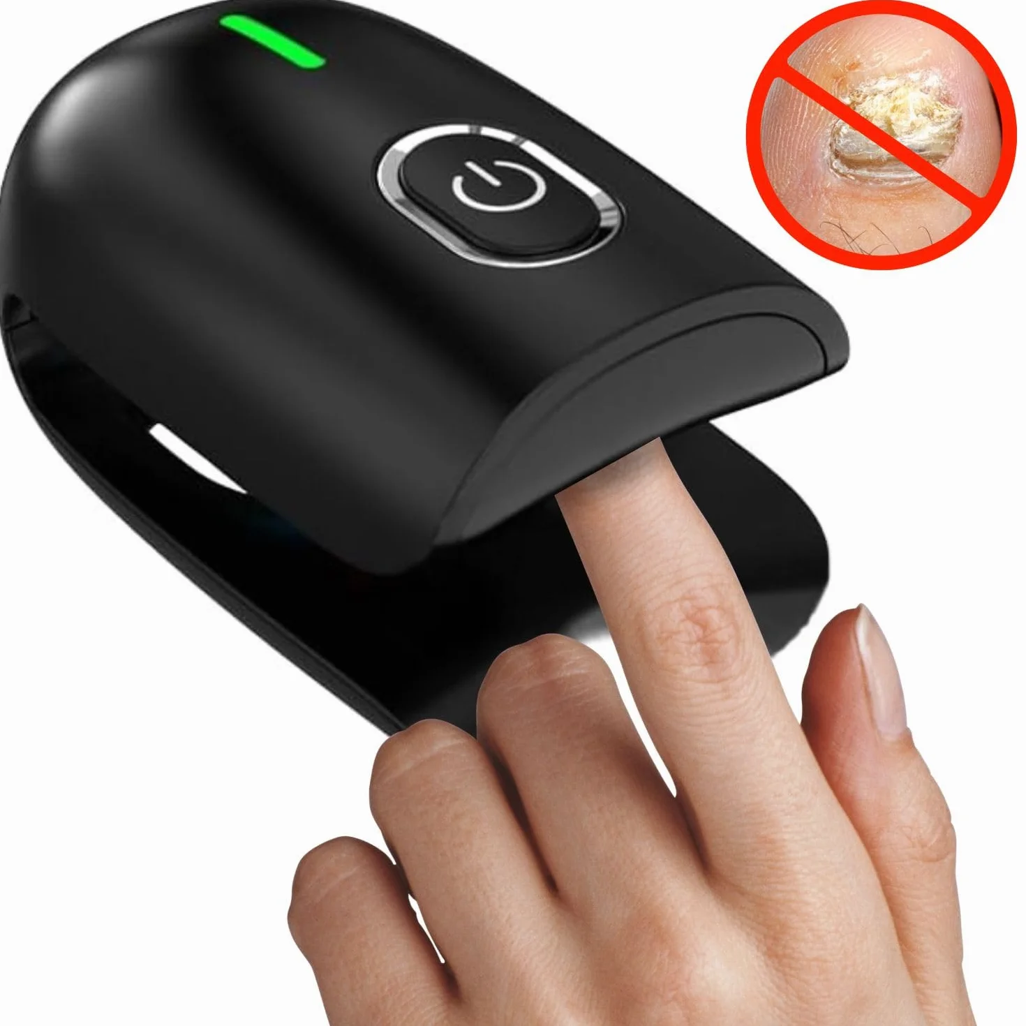 Tratamiento Hongos Uñas Pies Láser Onicomicosis Antifúngico Eliminar Micosis (Negro)