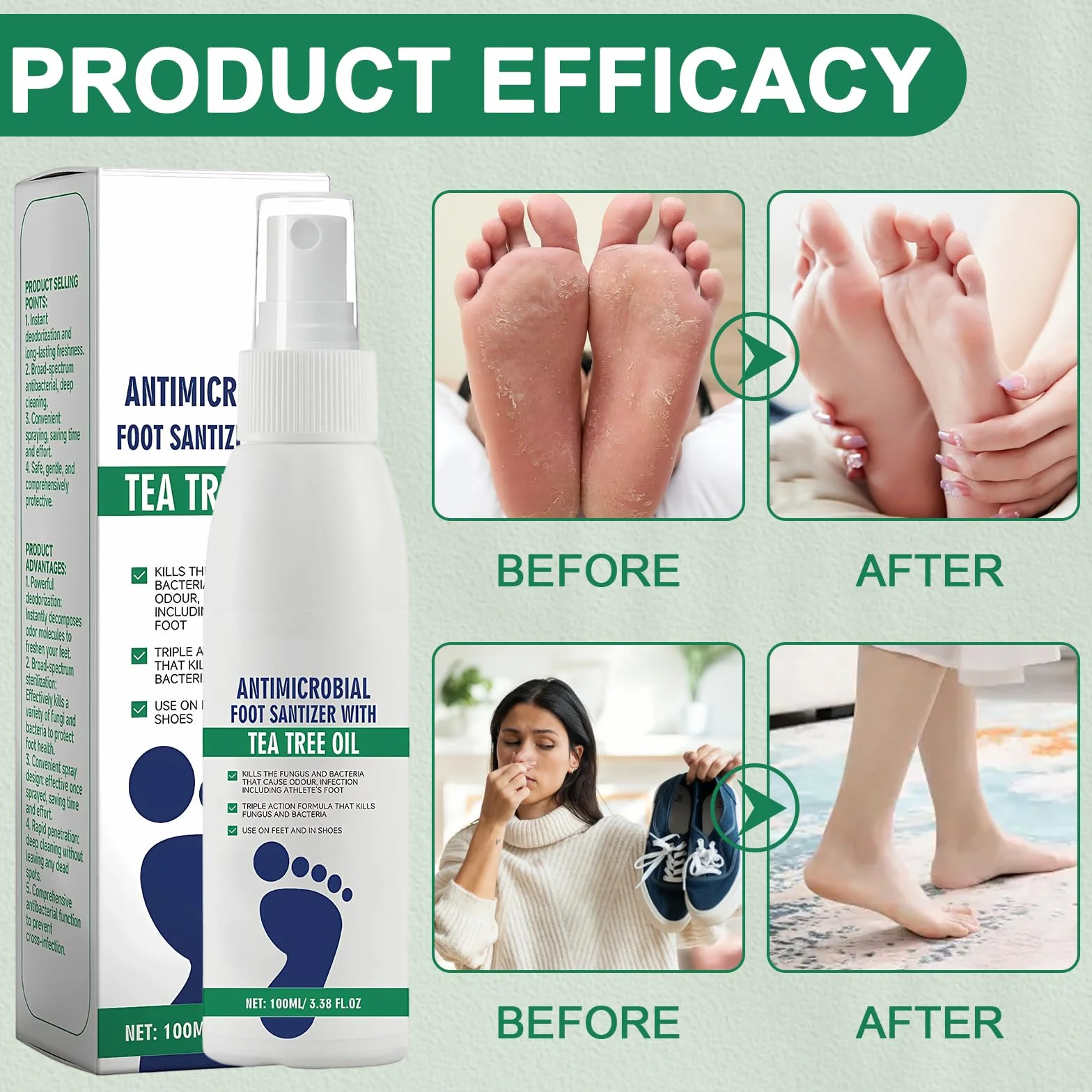 Hongos Pies Desodorante De Pies Tratamiento Para Aliviar Infecciones Pie De Atleta 4x100ml