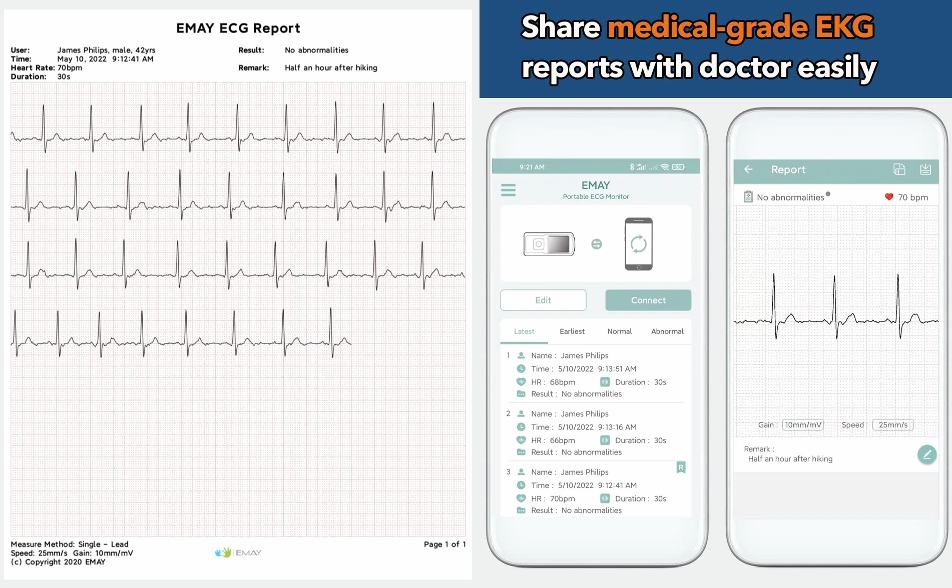 EMAY Monitor Inalámbrico de Salud Cardíaca (para iPhone y Android, Mac y Windows), Monitor Portátil de Frecuencia Cardíaca y Ritmo