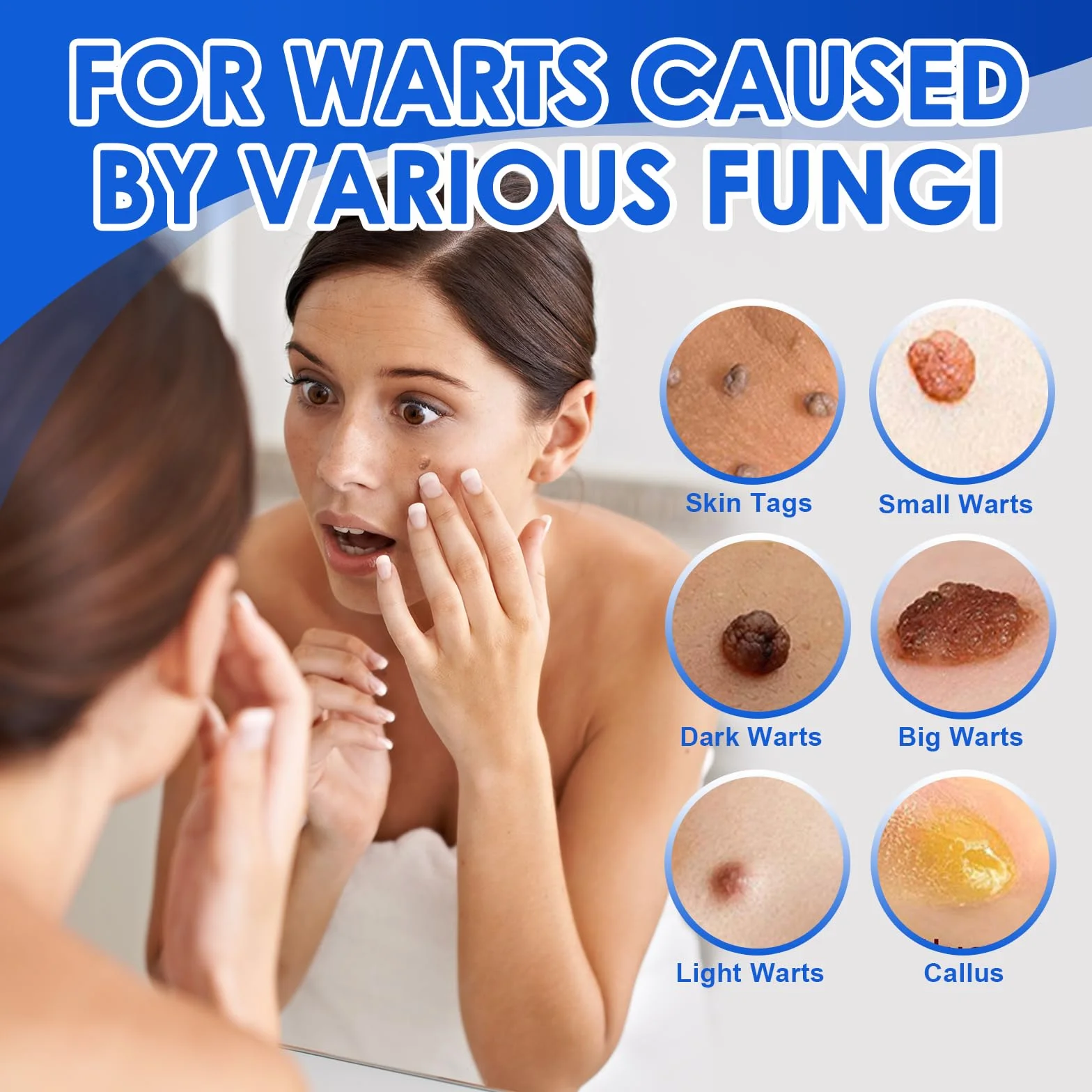 Líquido exfoliante para verrugas 30 ml cuidado piel áspera