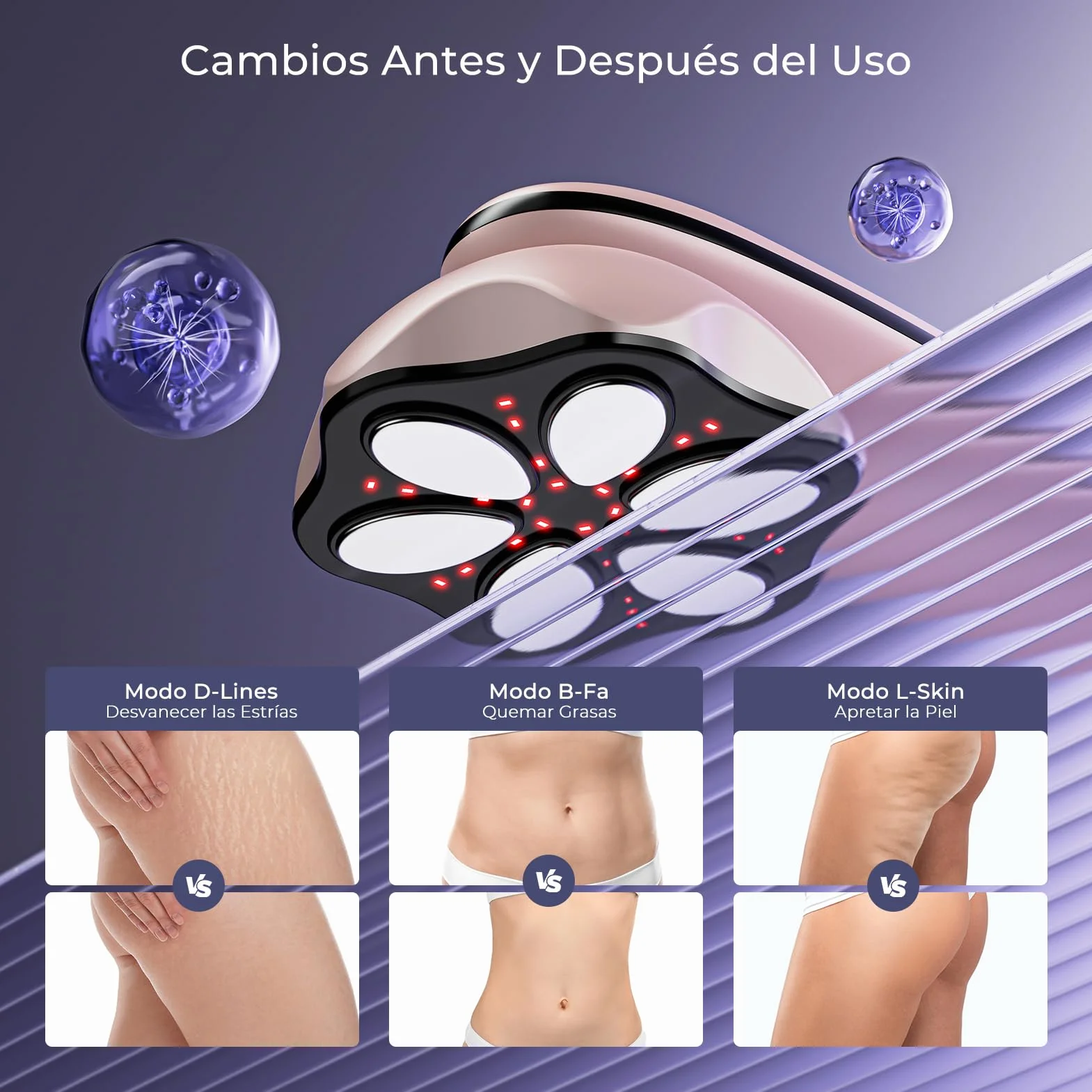 Masajeador Anticelulítico Profesional Eléctrico para Mujeres y Hombres, Oro Rosa