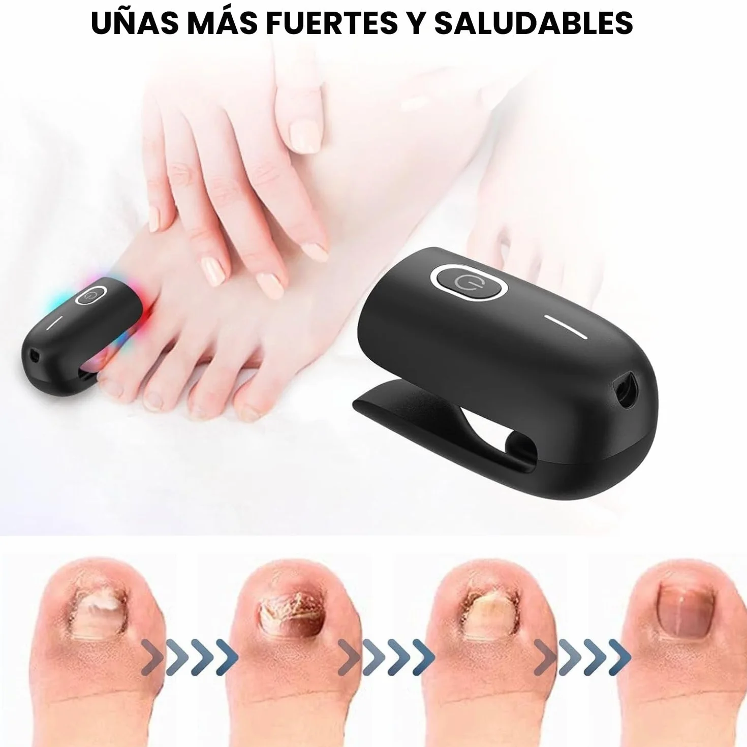 Tratamiento Hongos Uñas Pies Láser Onicomicosis Antifúngico Eliminar Micosis (Negro)
