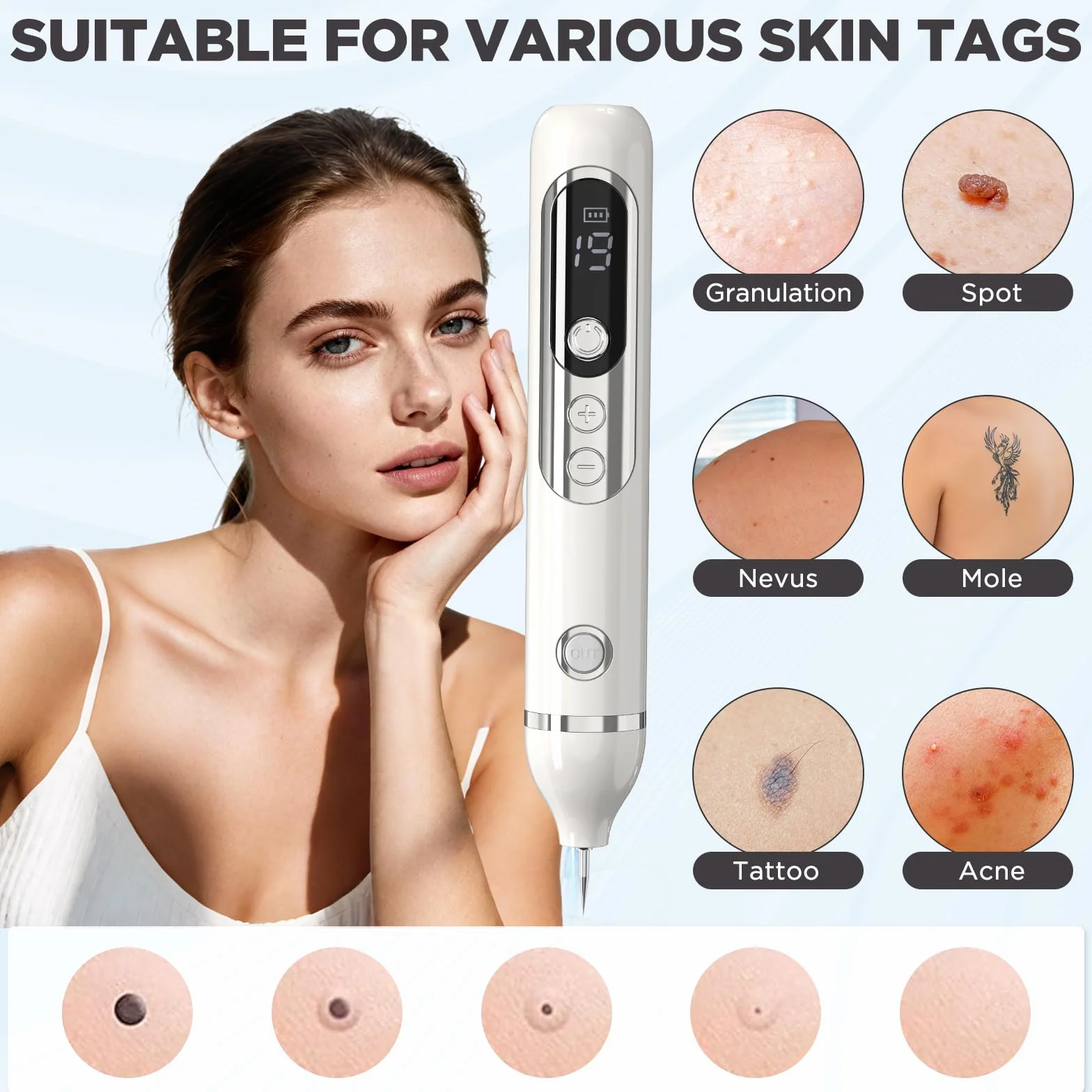 Lápiz Eliminar Verrugas Plasma 19 Niveles Intensidad Luz LCD Aguja Reemplazable Rostro Cuerpo