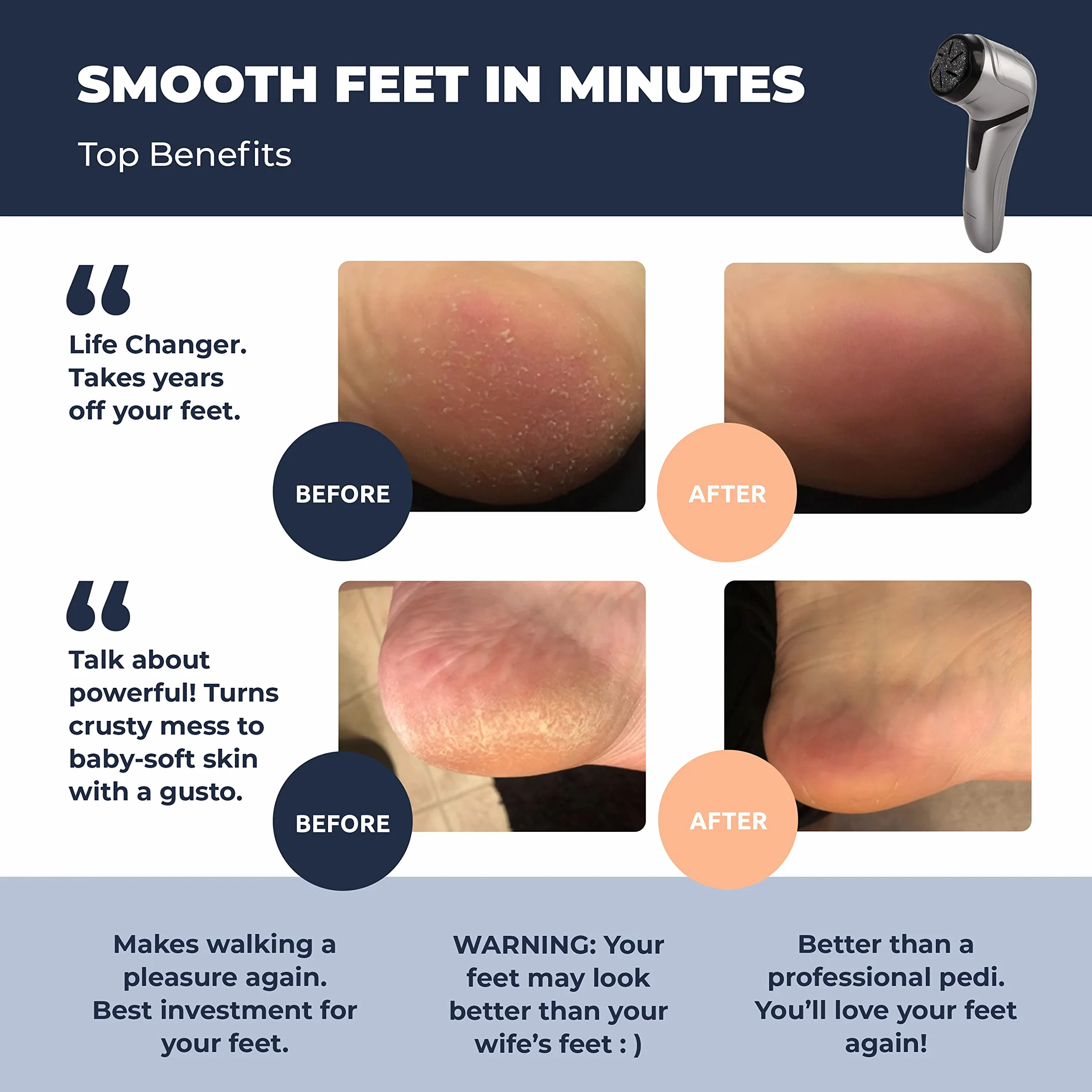 Own Harmony Lima Eléctrica Pies Absorción Vacío Pedicura Profesional Máquina Callos Recargable CR2100