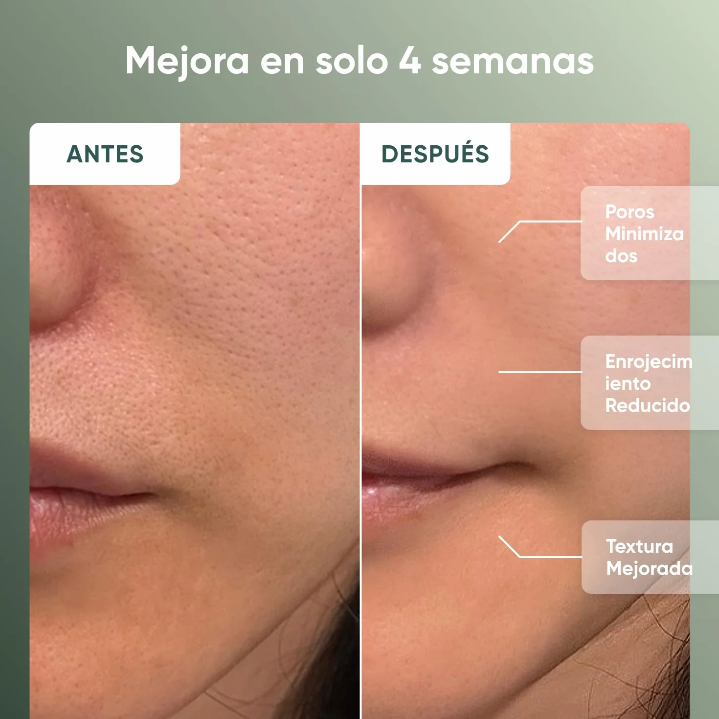 Nanoleaf Máscara LED Facial Terapia 7 Modos Luz Roja NIR Silicona Suave Fototerapia Recargable
