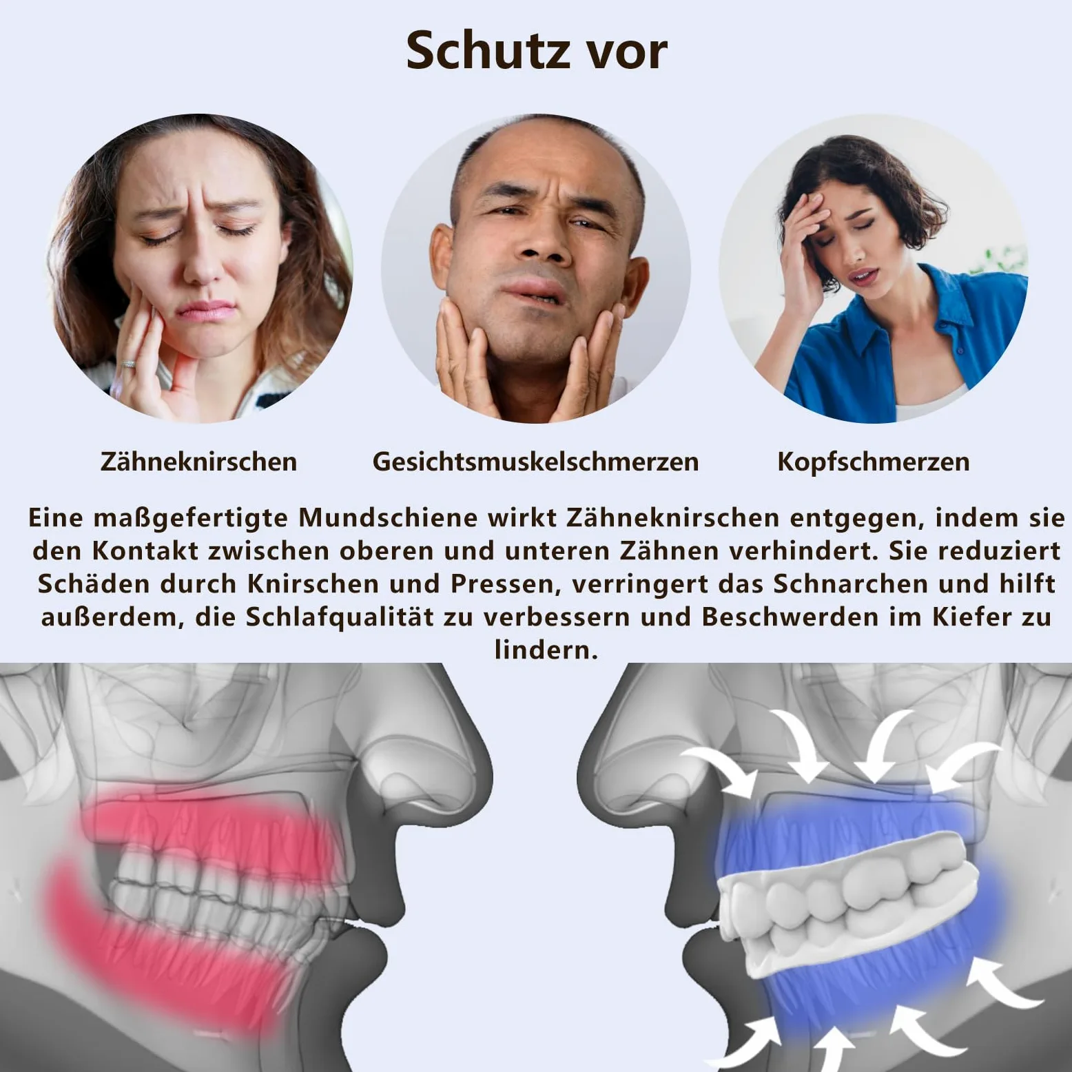 Férulas descarga bruxismo personalizada (Mandíbula sup. e inf.) | Sin BPA, cómodo y resistente, ajuste personalizado, sin molestias, protector bucal para bruxismo para adultos y adolescentes