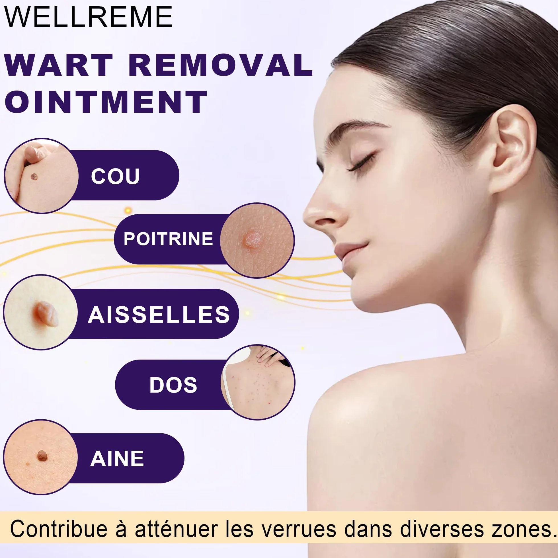 Crema eliminar verrugas 20g para verrugas plantares