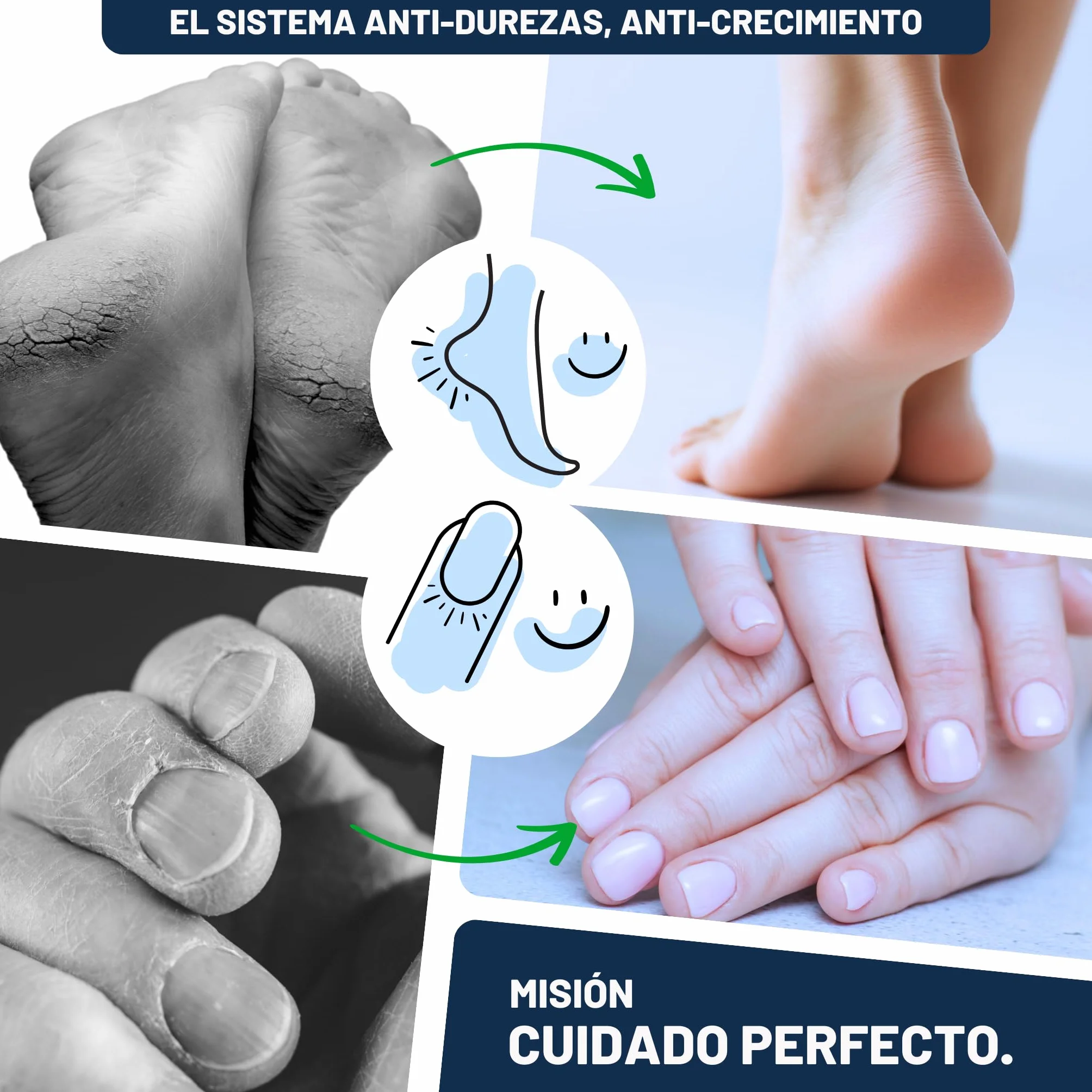 Mr. Fuss Eliminador de cutículas N.º 4 Plus Pack Steel 3 piezas 500 ml acero inoxidable