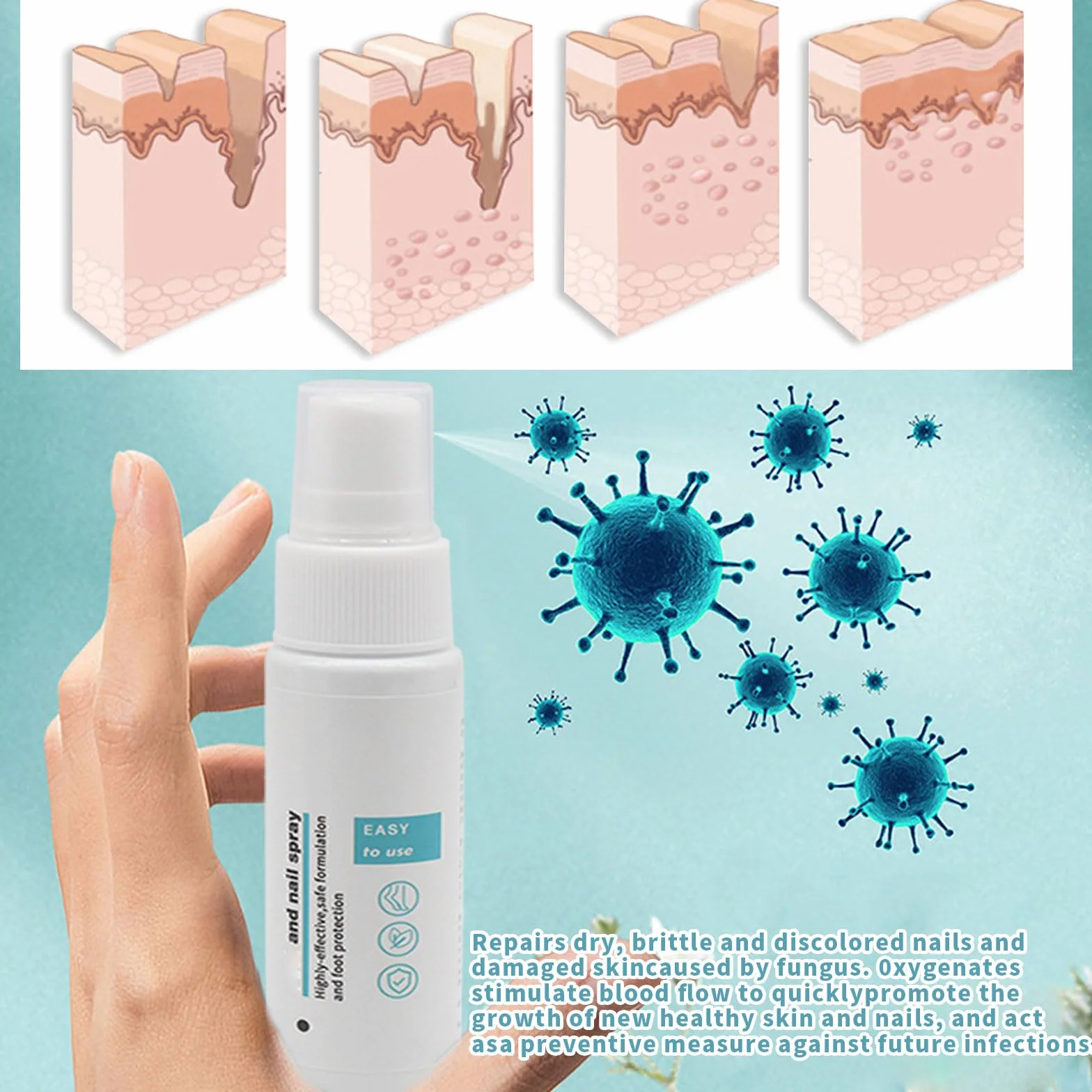 Spray para hongos en los pies y uñas, 2 unidades, reparación de uñas y control de olores