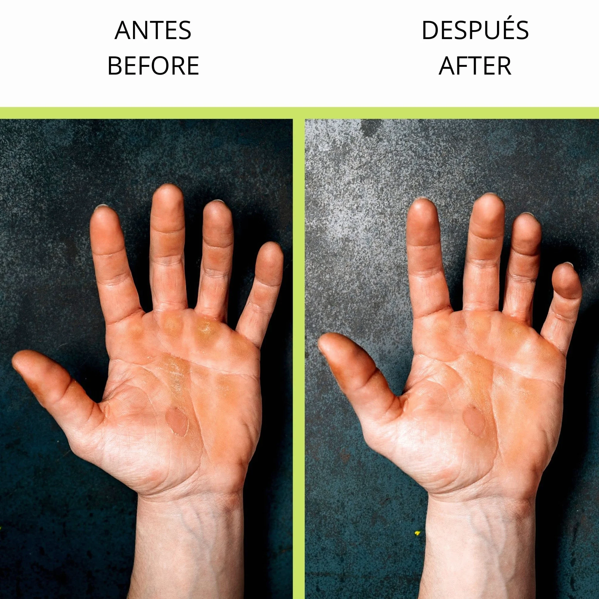 Velites Lija de Callos para Manos y Pies - Elimina Piel Muerta - Recambio Smooth Stone