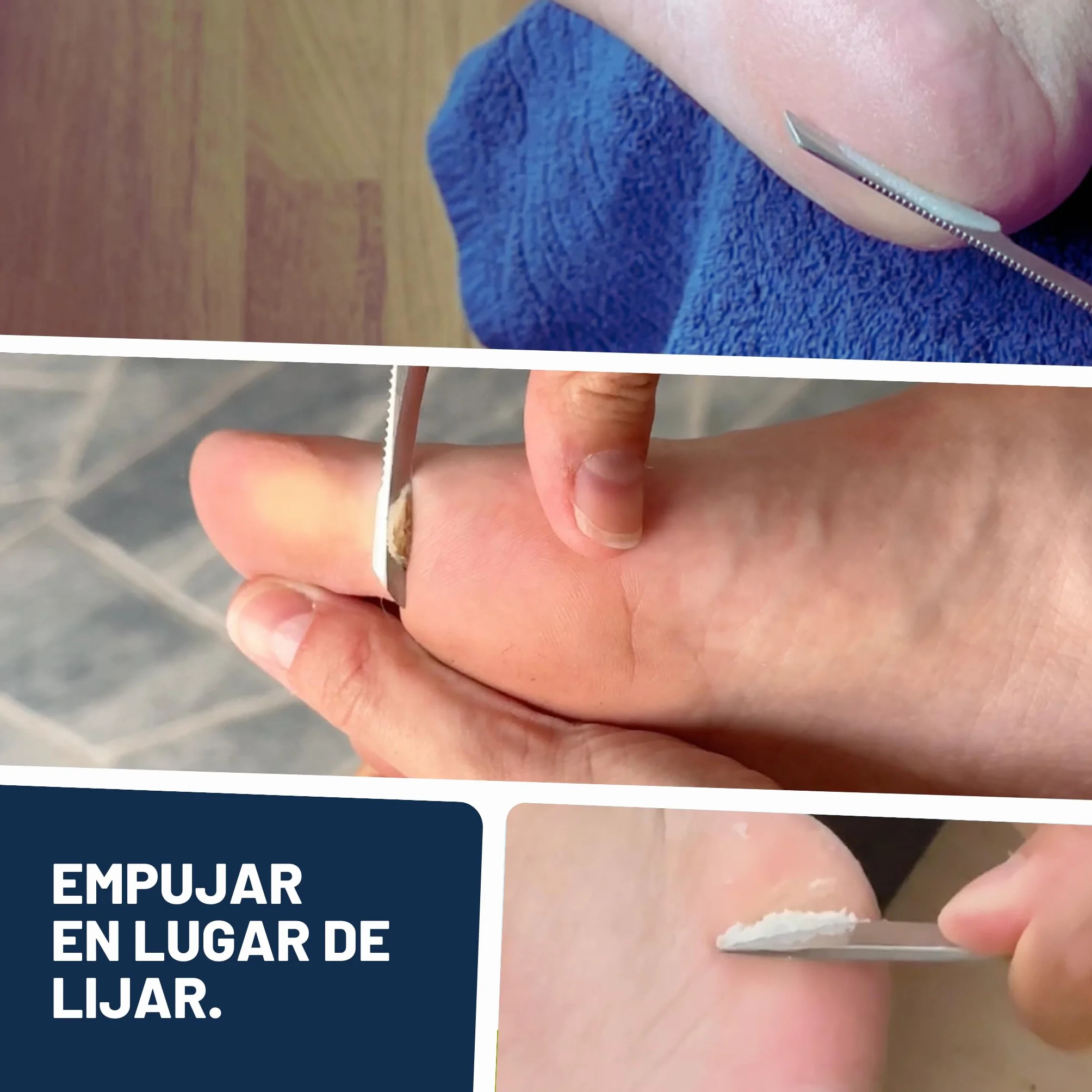 Mr. Fuss Eliminador de cutículas N.º 4 Plus Pack Steel 3 piezas 500 ml acero inoxidable