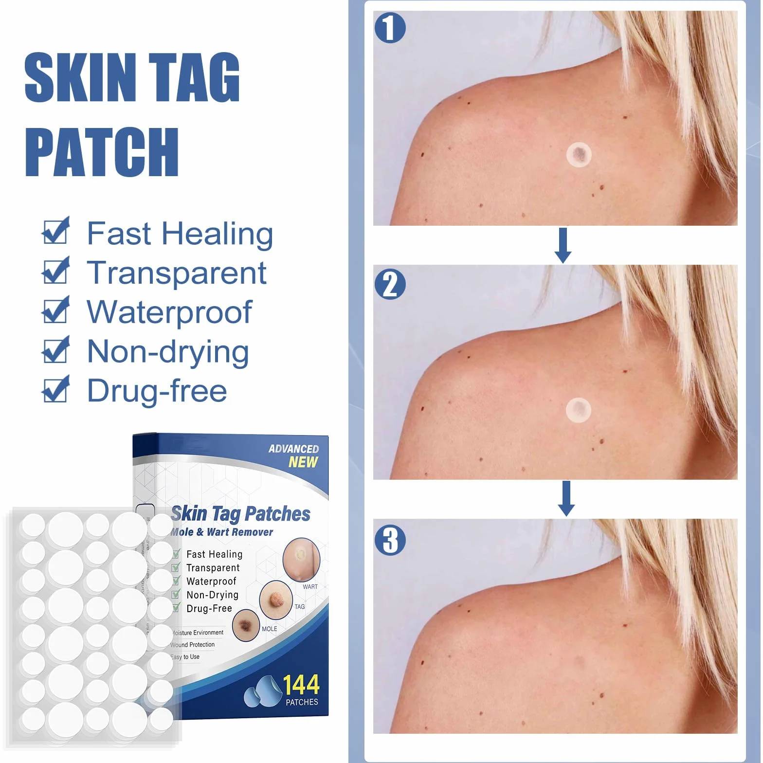 144 PCS Wart Remover, Quita Verruga Cuello Y Cara, Deje Que La Piel Sea Lisa