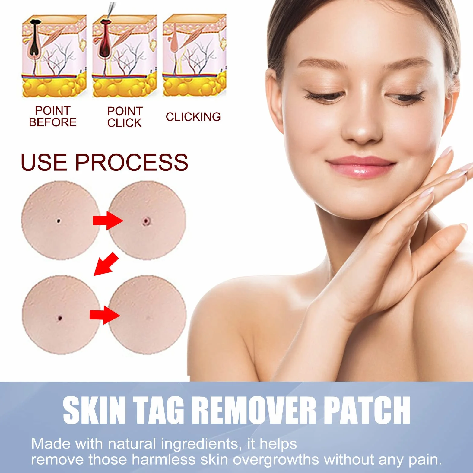 144 PCS Wart Remover, Quita Verruga Cuello Y Cara, Deje Que La Piel Sea Lisa
