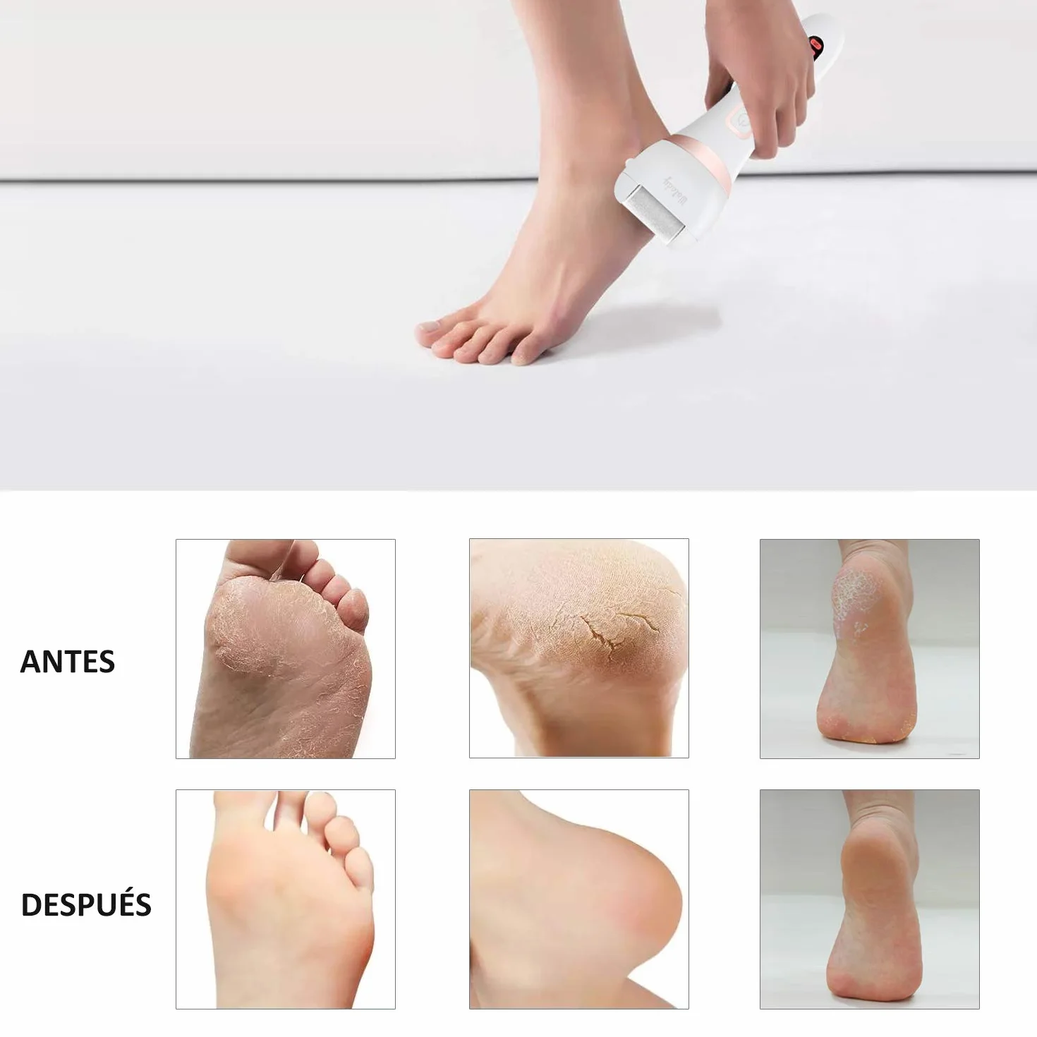 Wolady Lima Electrica Pedicura Profesional Recargable IPX7 Impermeable 1200MAH 2 Velocidades