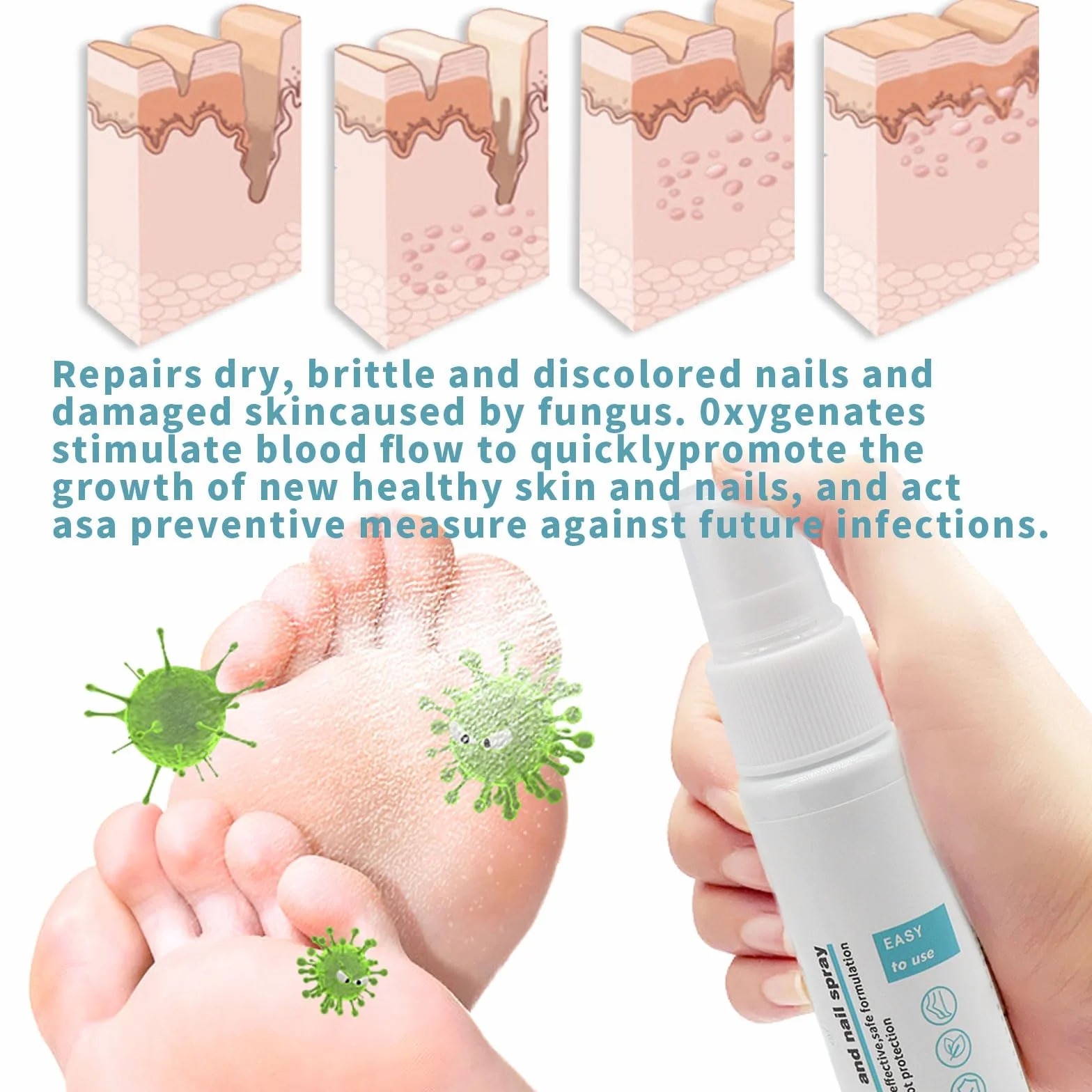 Spray para Hongos en Pies y Uñas, 2 unidades, Antifúngico, Control de Olores