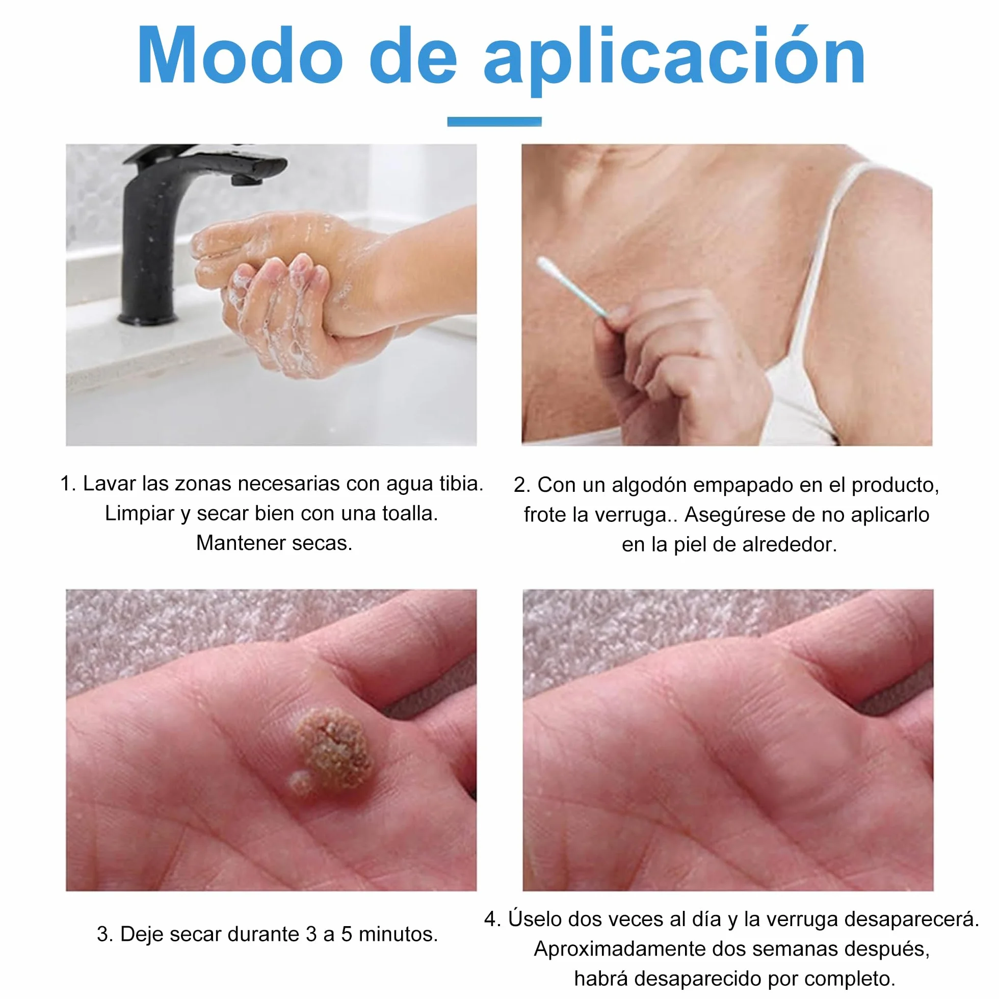 Crema para verrugas y acrocordones 20g Elimina verrugas comunes plantares callos