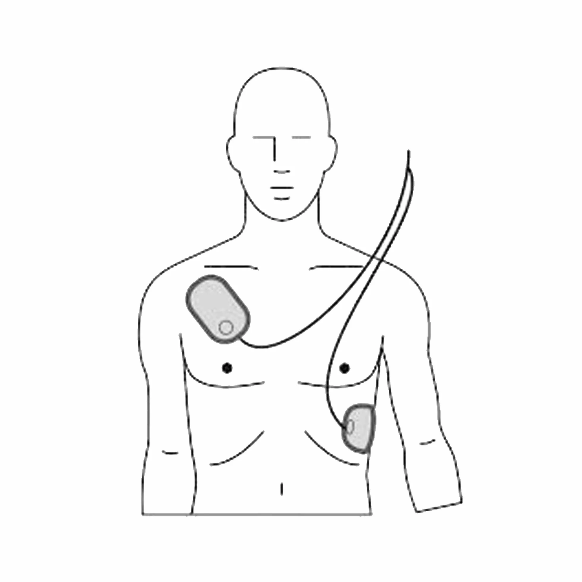 Set de electrodos adulto para desfibrilador AED7000, 2 años de caducidad