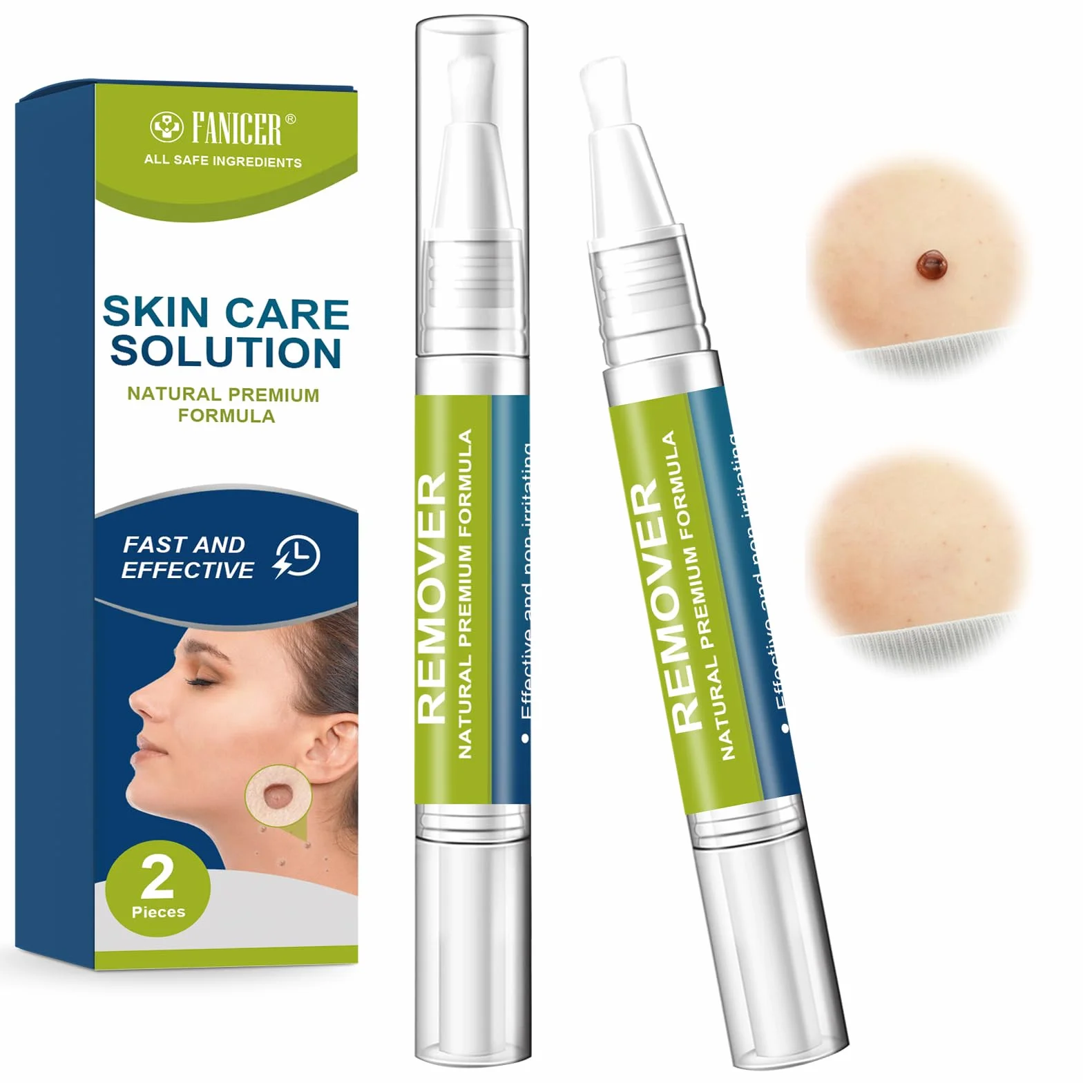Lápiz de verrugas 5ml, Solución para el cuidado de la piel, para manos y pies