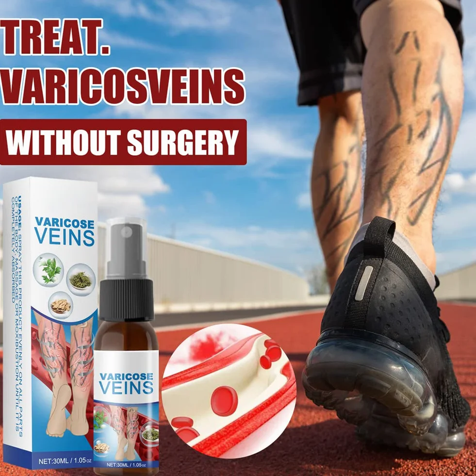 Spray Calmante para Venas Varicosas, Tratamiento de Varices, Alivio Dolor Pierna Circulación Sanguínea