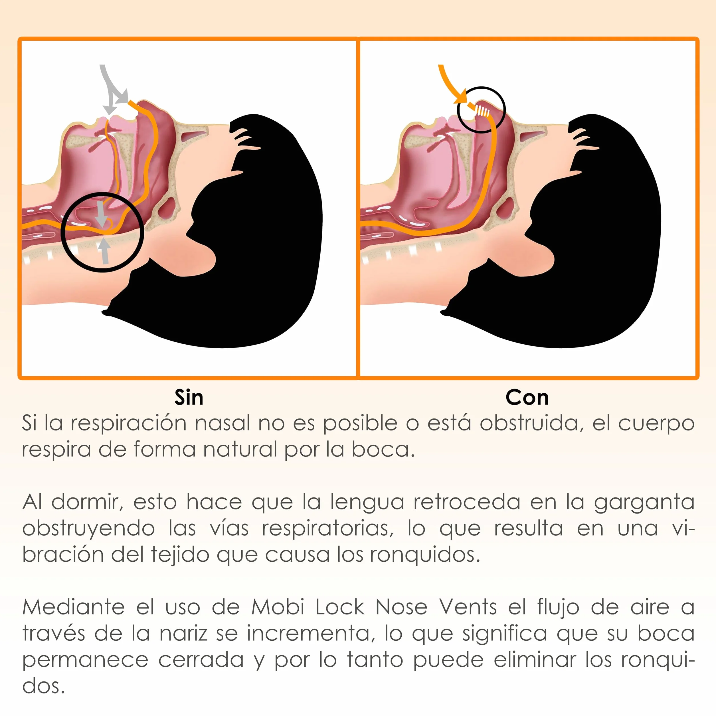 Dilatador nasal para aliviar la presión nasal Paquete de 12 Mediano Válvulas blandas Dispositivo reutilizable contra ronquidos