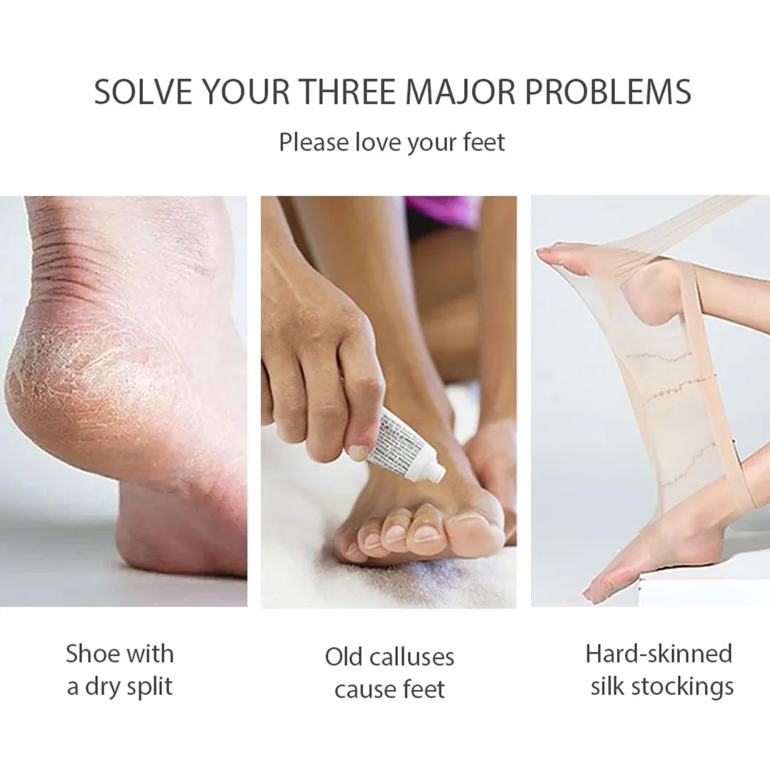 Piedra Pómez Natural para Pies, 2 Piezas Herramientas de Pedicura Exfoliante