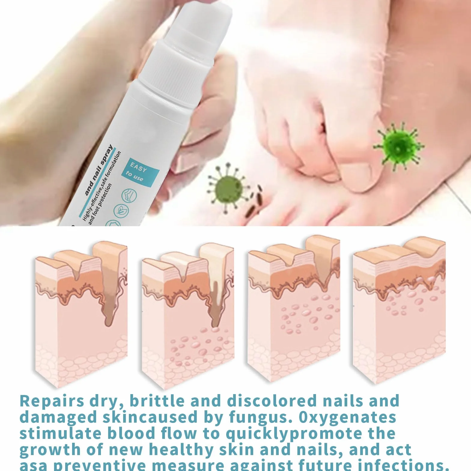 Spray Fungicida Contra Hongos En Los Pies, 2 x 30ml Tratamiento Para Uñas y Pies
