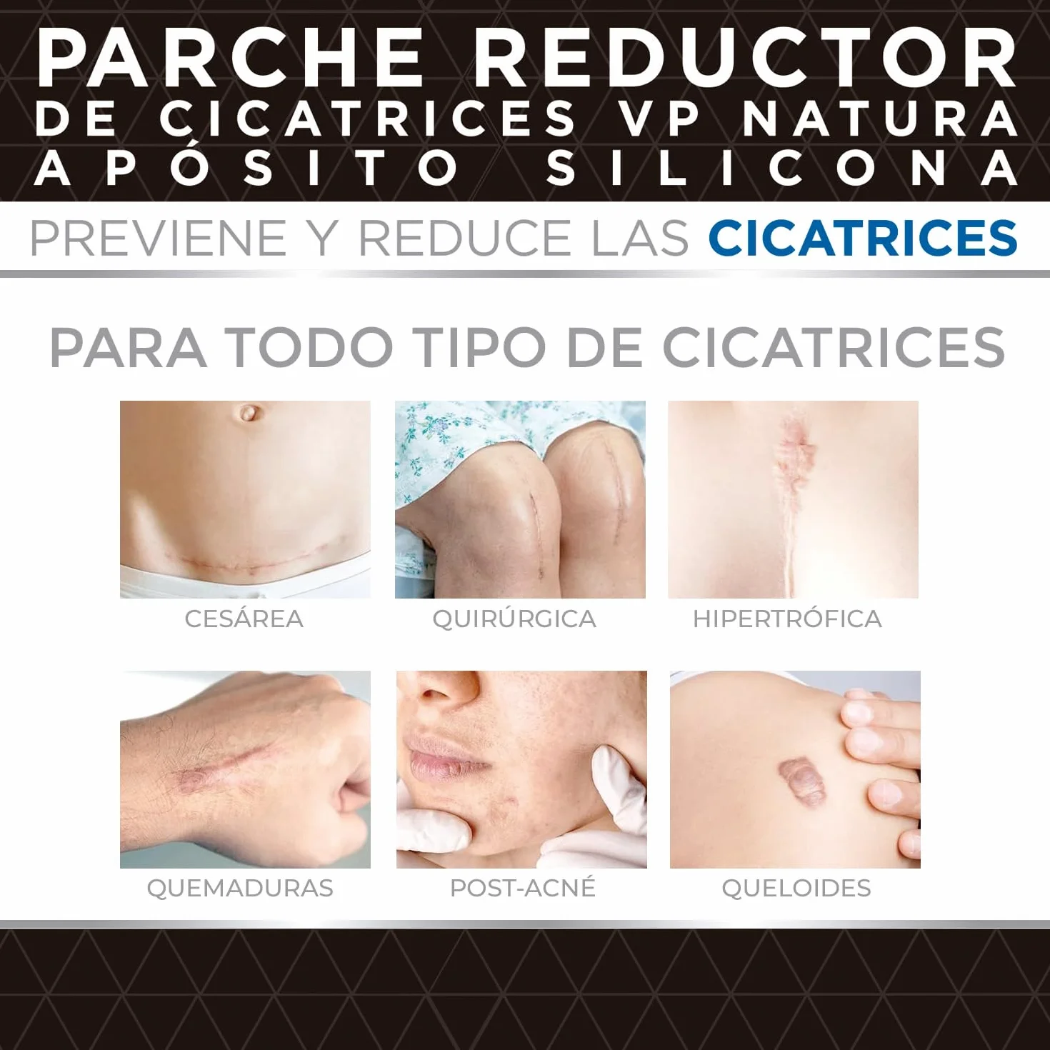 VP PHARMA Parches Cicatrizantes de Silicona 4x30 cm 5 unidades, Adhesión Duradera con Protección Solar