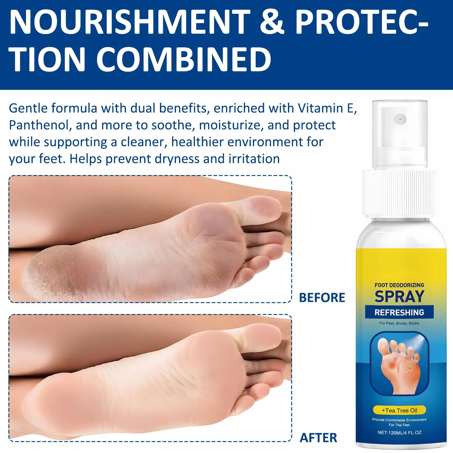Spray Para Pies Aceite De Árbol De Té 120 ML, Desodorante Para Pies Elimina Mal Olor